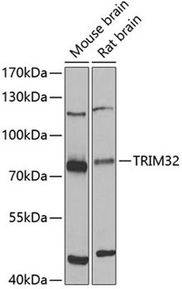 Western blot - TRIM32 antibody (A7079)