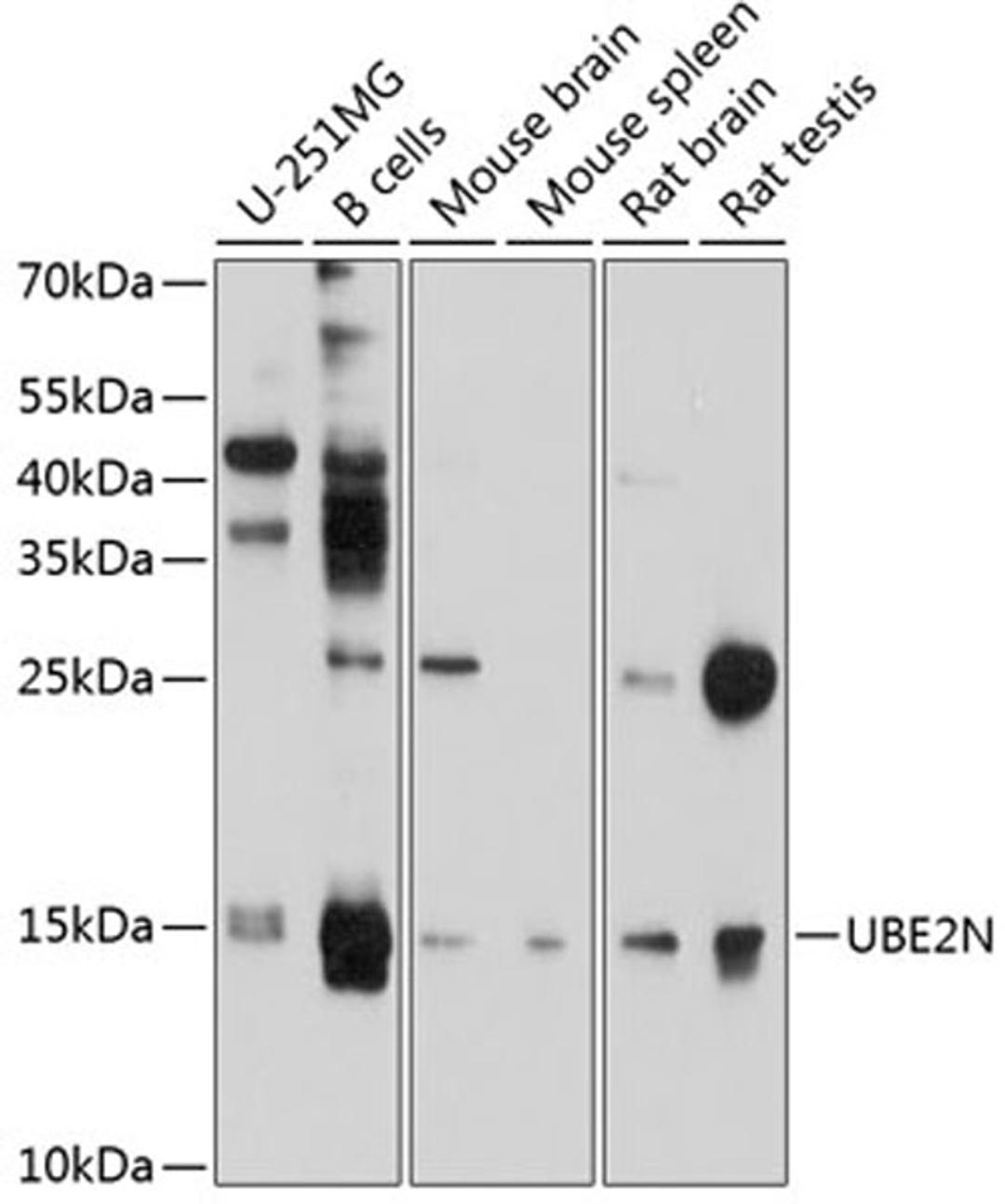 Western blot - UBE2N antibody (A10543)