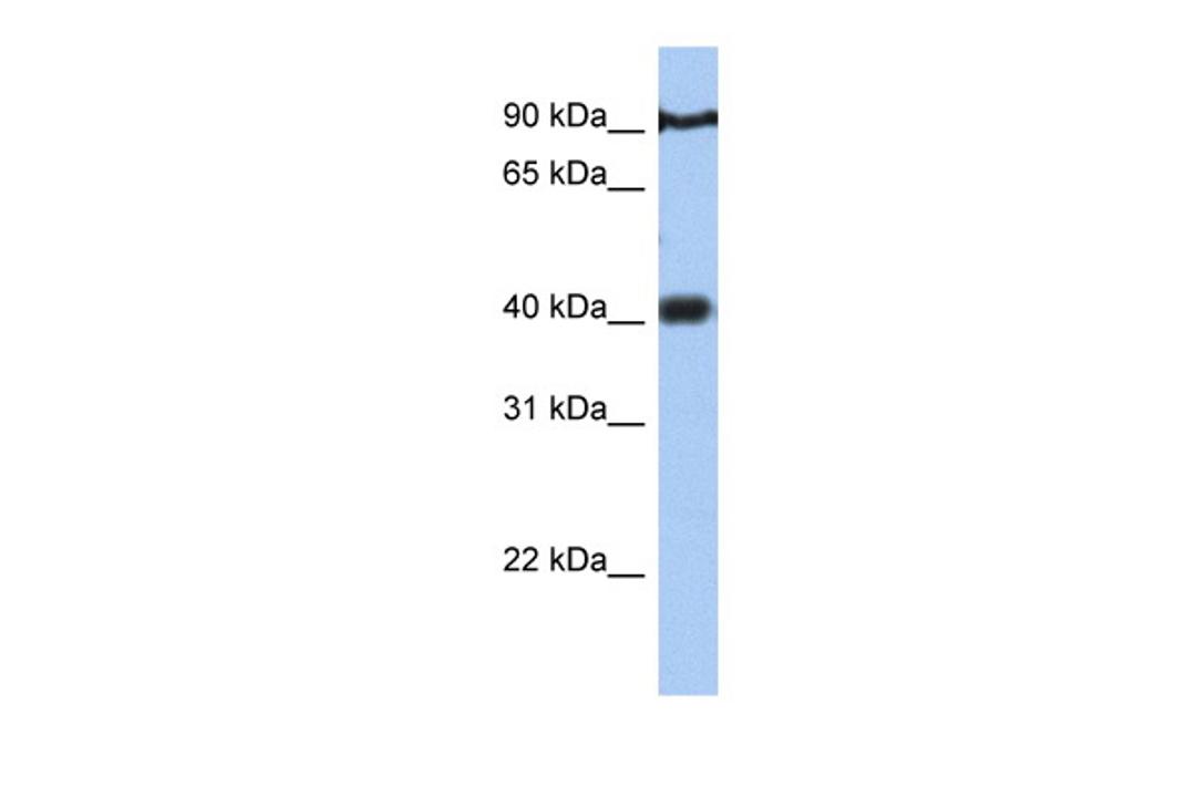 Antibody used in WB on Human Jurkat 0.2-1 ug/ml.