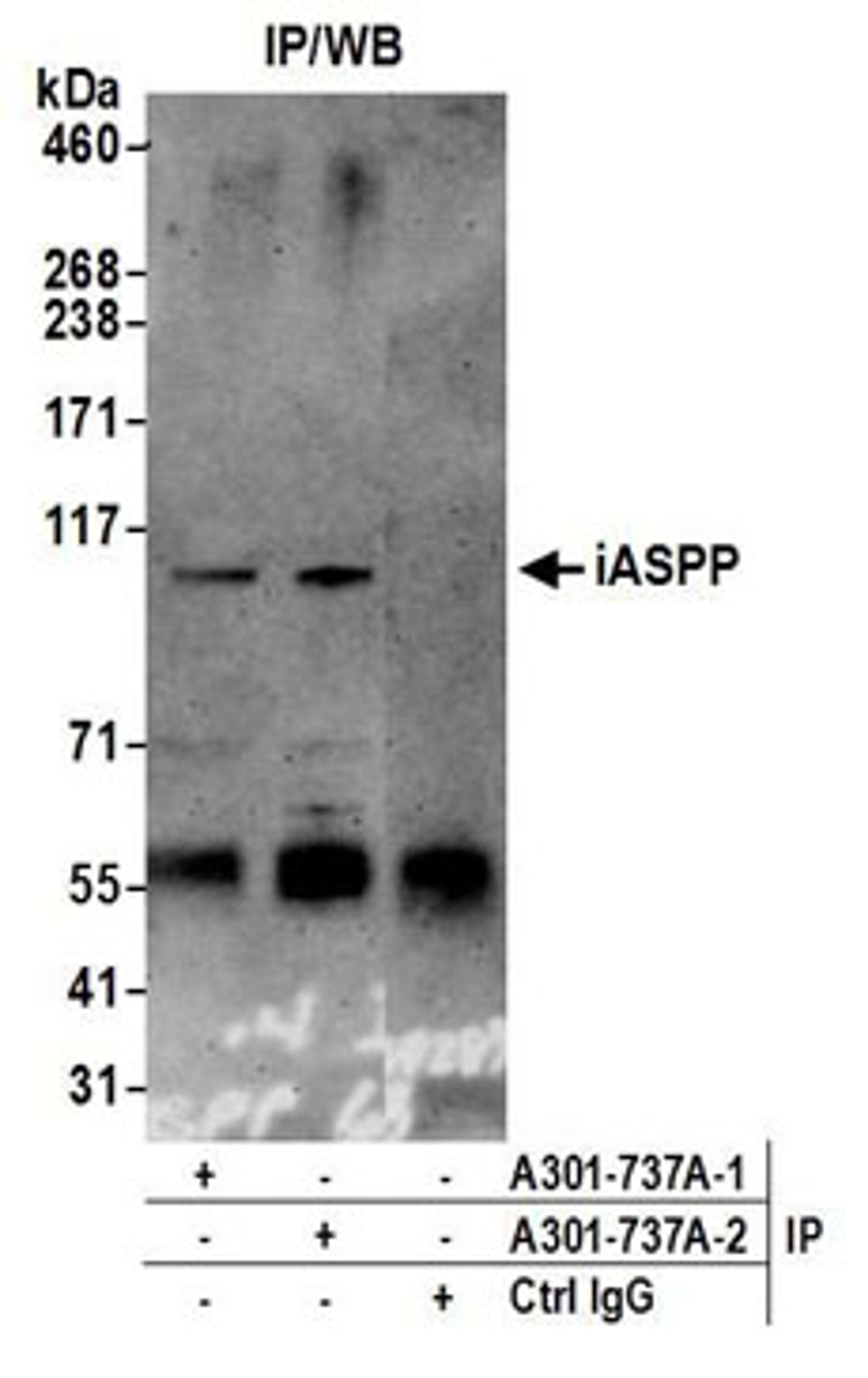 Detection of human iASPP by western blot of immunoprecipitates.