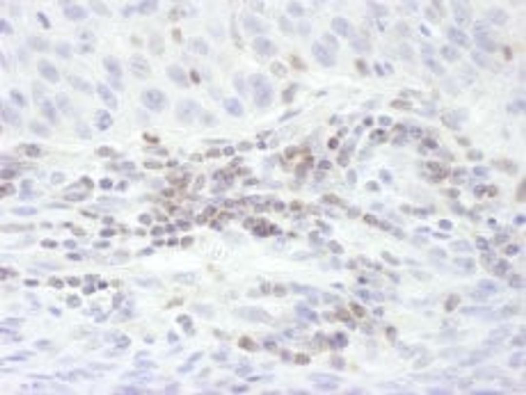 Detection of human STAT5b by immunohistochemistry.