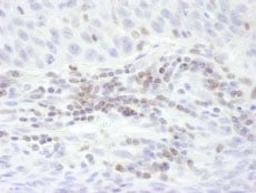 Detection of human STAT5b by immunohistochemistry.