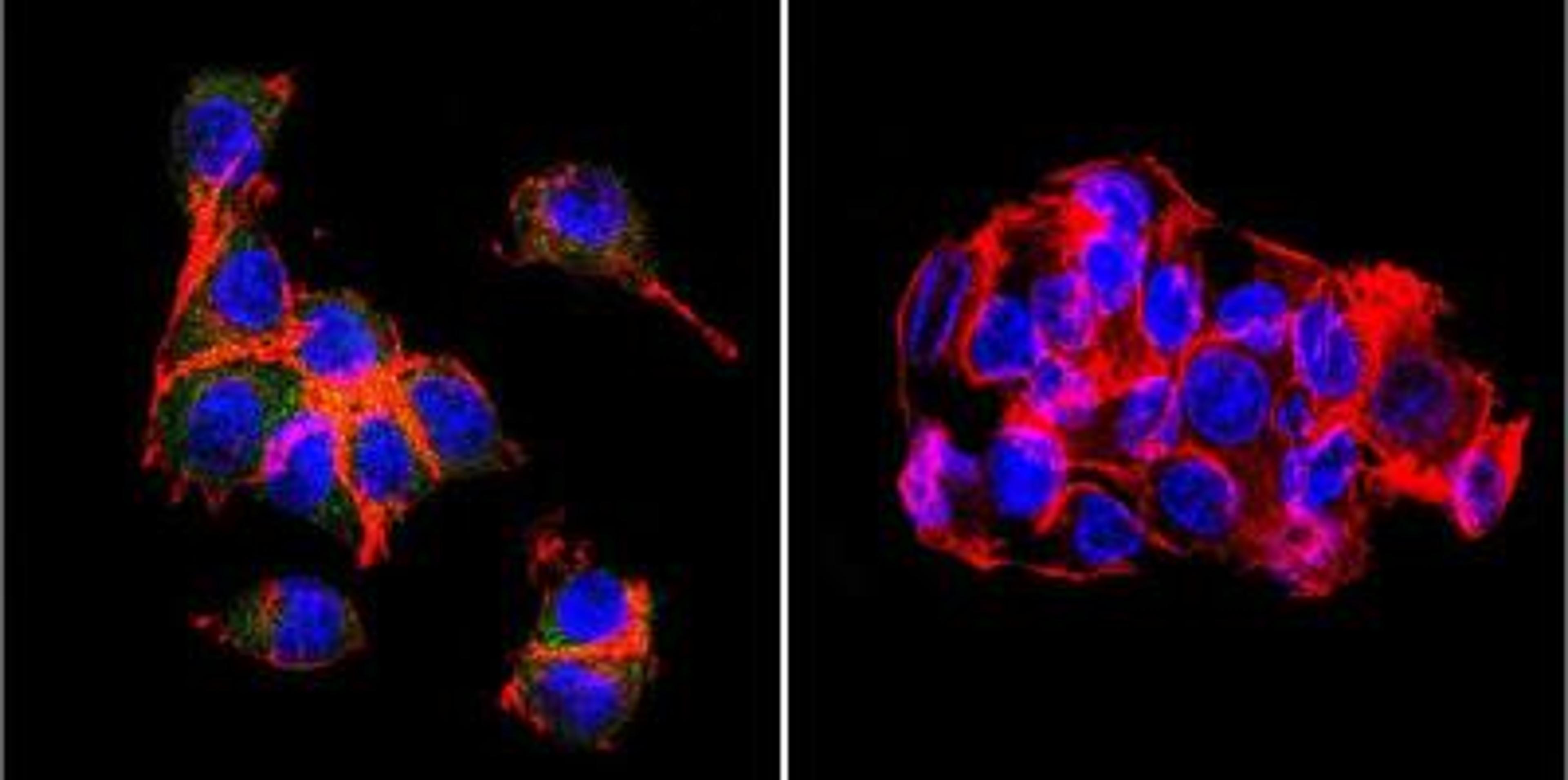 Immunocytochemistry/Immunofluorescence: OATP2/8 Antibody (MDQ) [NB100-74482] - Analysis of OATP8 in HepG2 Cells. Cells were grown on chamber slides and fixed with formaldehyde prior to staining. Cells were probed without (control) or with a OATP8 monoclonal antibody at a dilution of 1:20 overnight at 4C, washed with PBS and incubated with a DyLight-488 conjugated secondary antibody. OATP8 staining (green), F-Actin staining with Phalloidin (red) and nuclei with DAPI (blue) is shown.