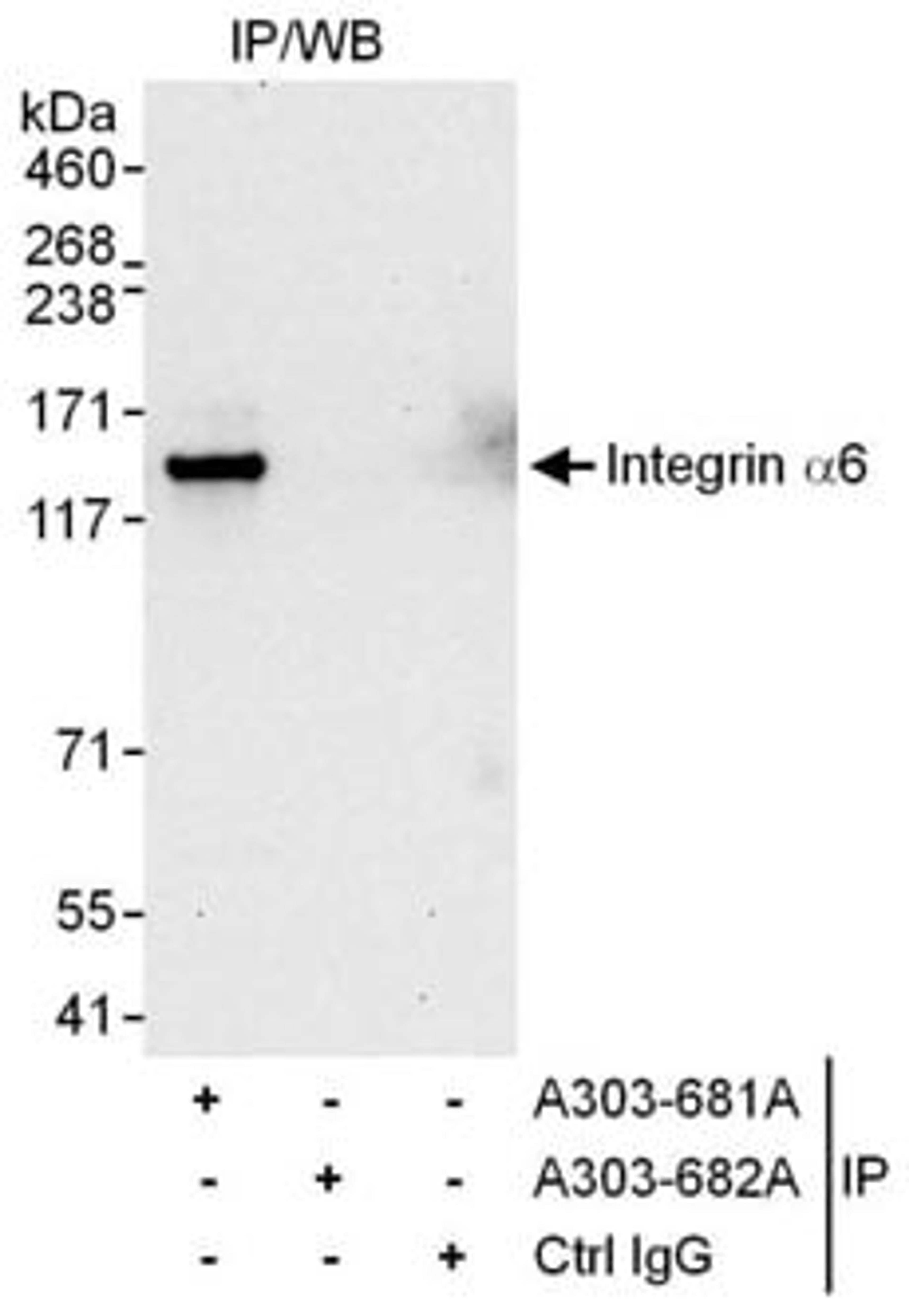 Detection of human Integrin Alpha 6 by western blot of immunoprecipitates.