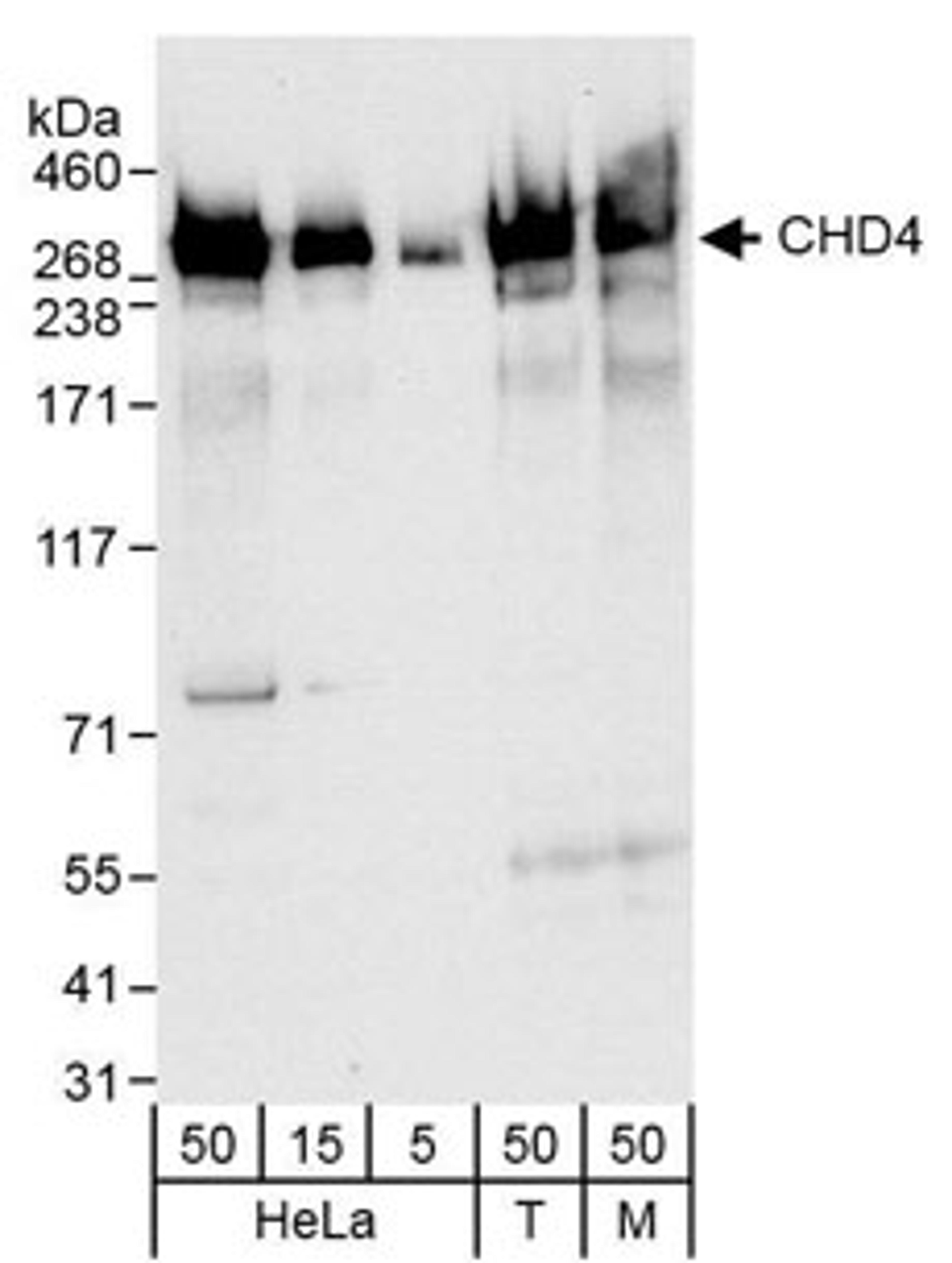 Detection of human and mouse CHD4 by western blot.