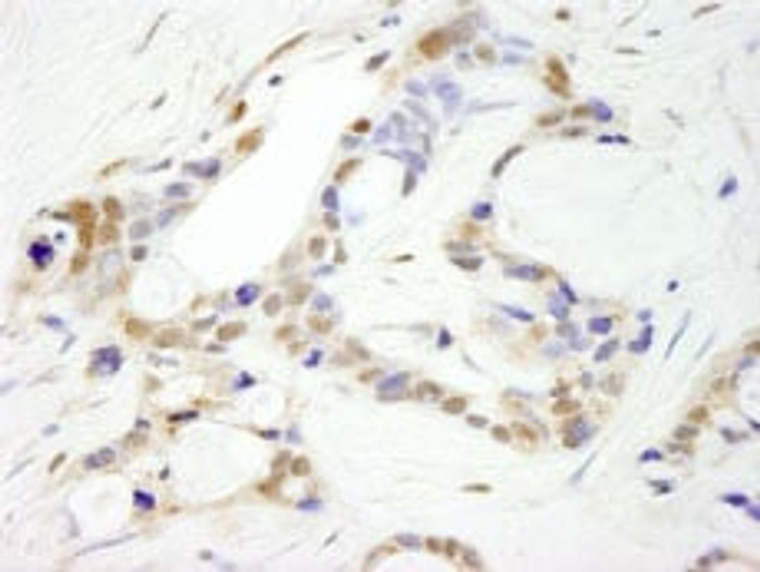 Detection of human CPSF100 immunohistochemistry.