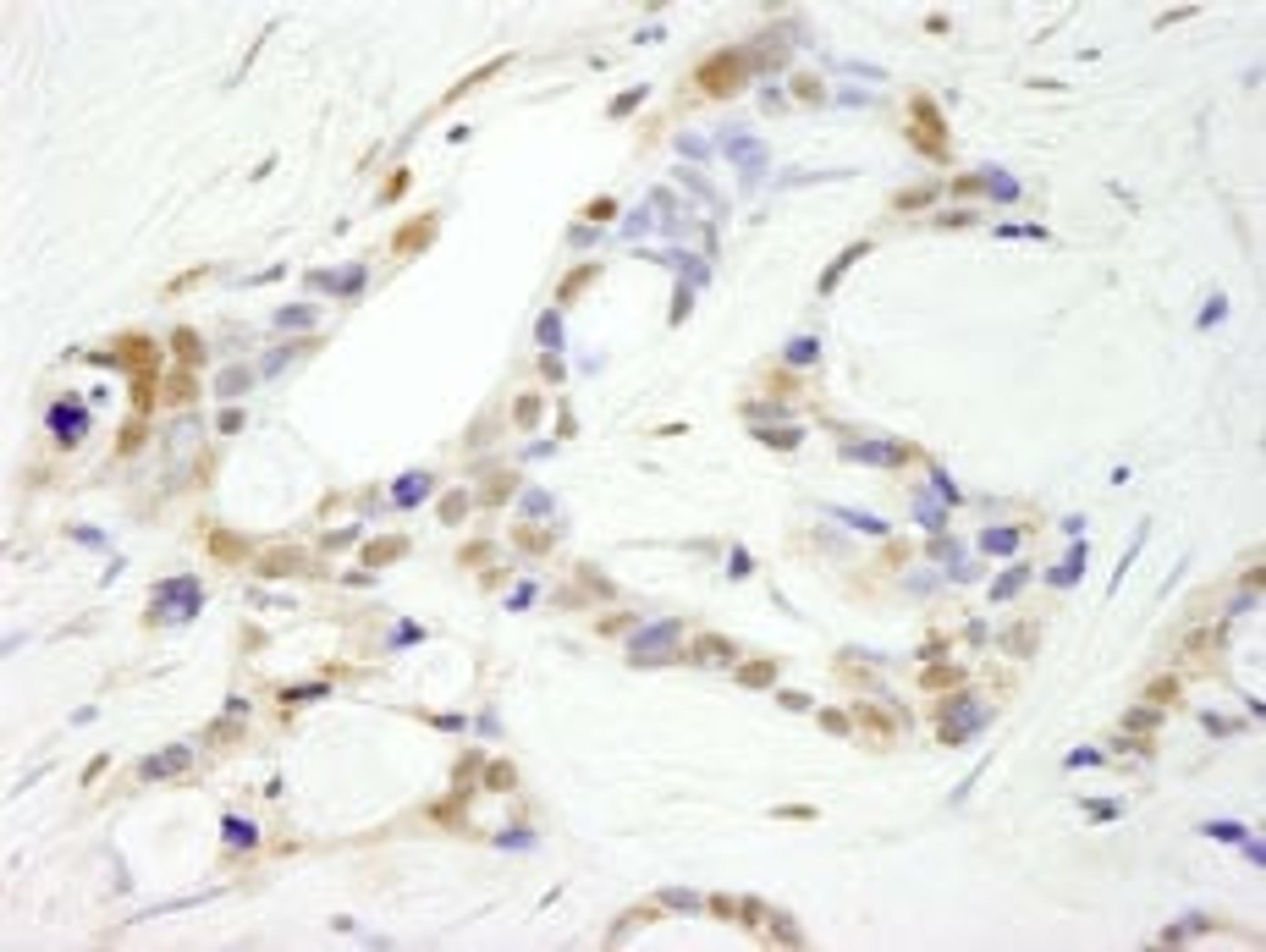 Detection of human CPSF100 immunohistochemistry.