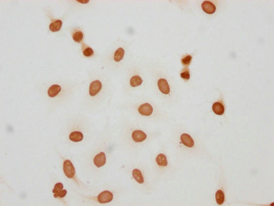 Immunocytochemistry analysis of CSB-PA010389PA05hibHU diluted at 1:150 and staining in Hela cells(treated with 30mM sodium butyrate for 4h) performed on a Leica BondTM system. The cells were fixed in 4% formaldehyde, permeabilized using 0.2% Triton X-100 and blocked with 10% normal goat serum 30min at RT. Then primary antibody (1% BSA) was incubated at 4°C overnight. The primary is detected by a biotinylated secondary antibody and visualized using an HRP conjugated SP system.