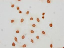 Immunocytochemistry analysis of CSB-PA010389PA05hibHU diluted at 1:150 and staining in Hela cells(treated with 30mM sodium butyrate for 4h) performed on a Leica BondTM system. The cells were fixed in 4% formaldehyde, permeabilized using 0.2% Triton X-100 and blocked with 10% normal goat serum 30min at RT. Then primary antibody (1% BSA) was incubated at 4°C overnight. The primary is detected by a biotinylated secondary antibody and visualized using an HRP conjugated SP system.