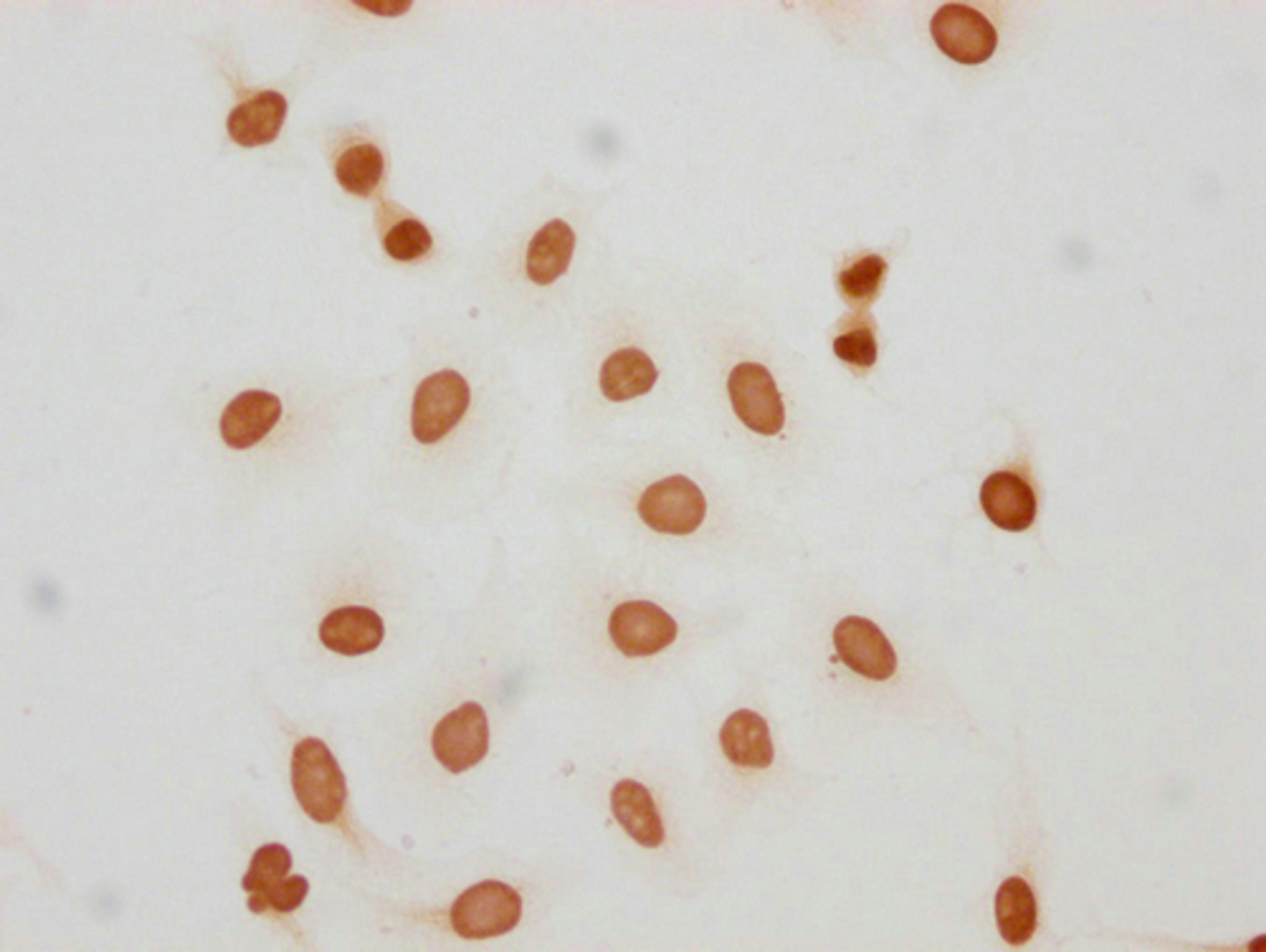 Immunocytochemistry analysis of CSB-PA010389PA05hibHU diluted at 1:150 and staining in Hela cells(treated with 30mM sodium butyrate for 4h) performed on a Leica BondTM system. The cells were fixed in 4% formaldehyde, permeabilized using 0.2% Triton X-100 and blocked with 10% normal goat serum 30min at RT. Then primary antibody (1% BSA) was incubated at 4°C overnight. The primary is detected by a biotinylated secondary antibody and visualized using an HRP conjugated SP system.