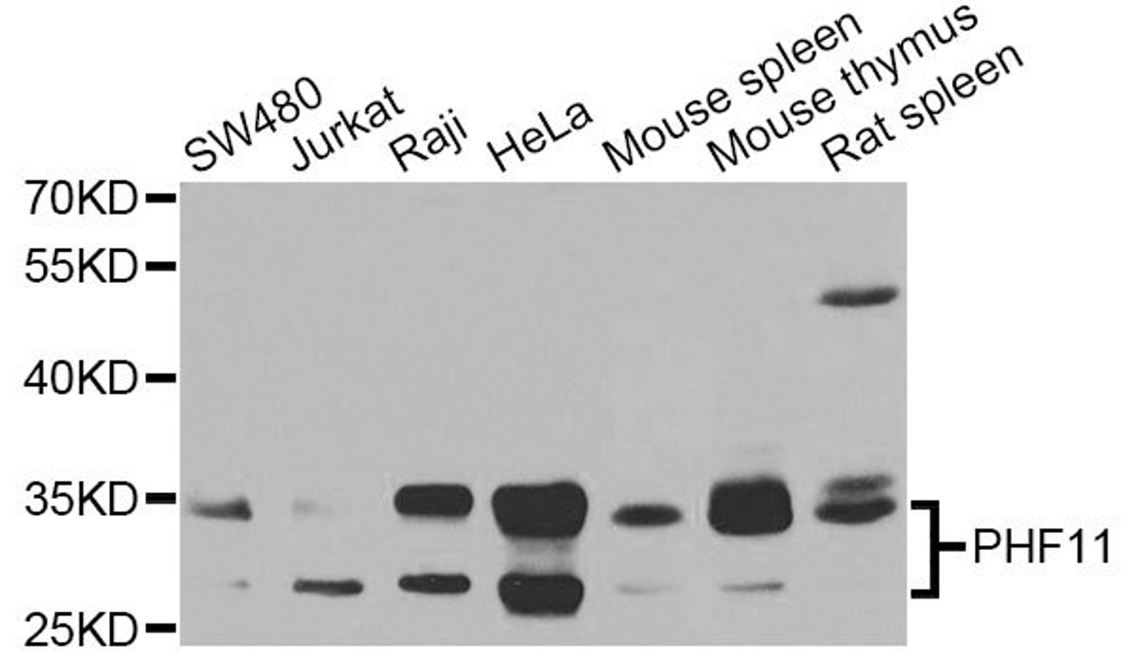 Western blot - PHF11 antibody (A7803)