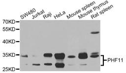 Western blot - PHF11 antibody (A7803)