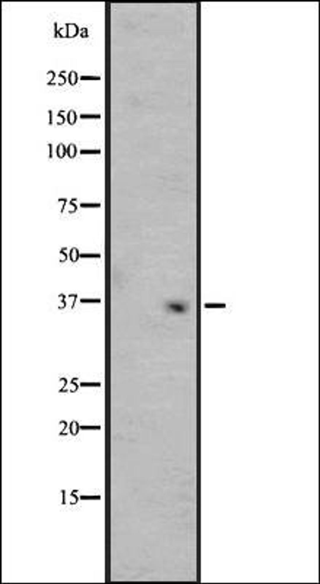 Western blot analysis of Y79 cell line lysate MCF7 whole cell lysate using OR4F3/4F21 antibody