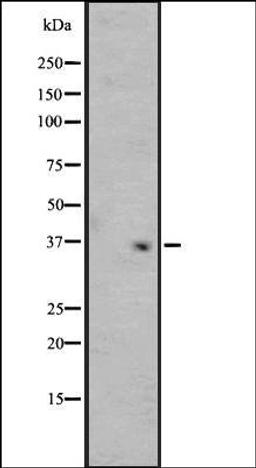 Western blot analysis of Y79 cell line lysate MCF7 whole cell lysate using OR4F3/4F21 antibody