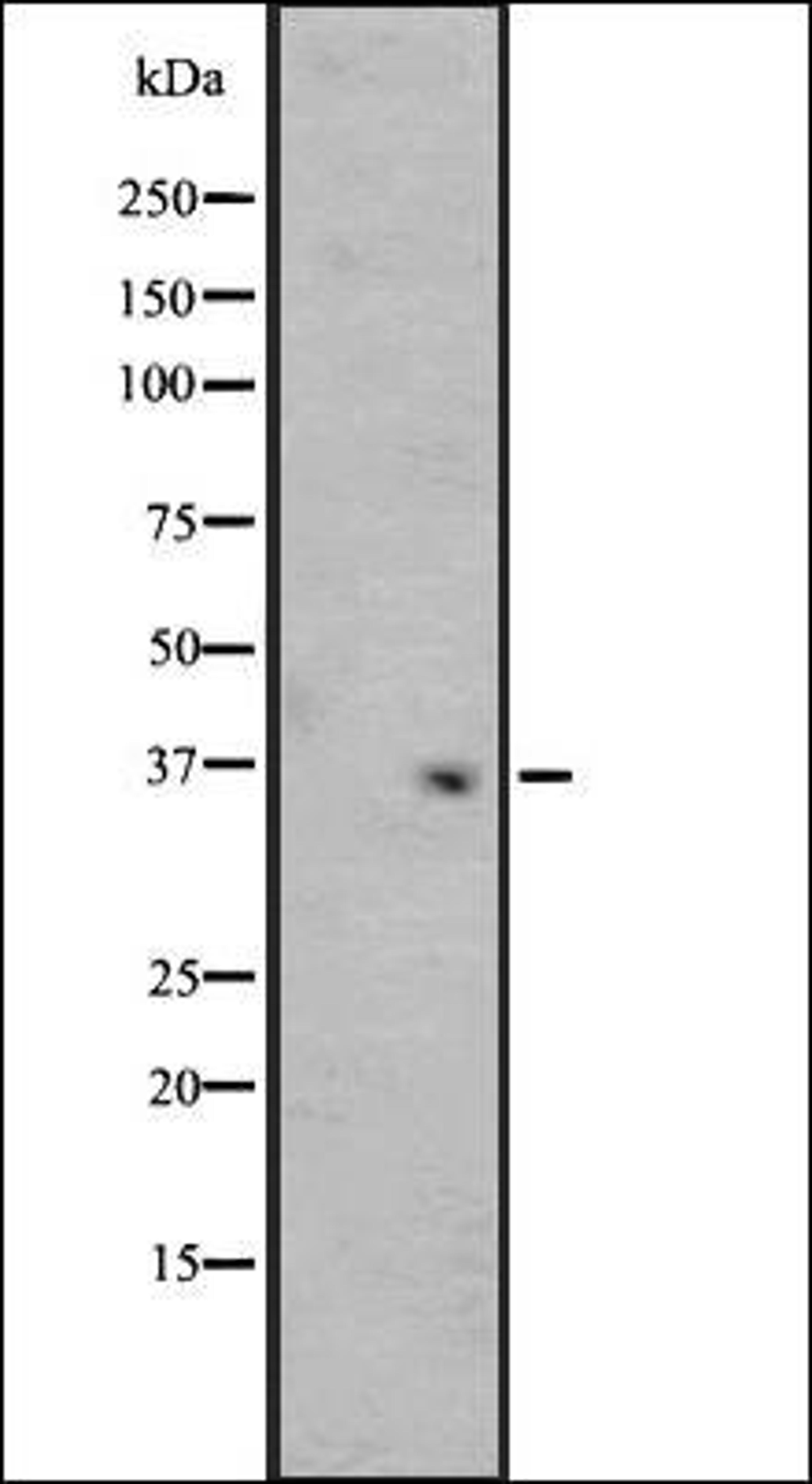 Western blot analysis of Y79 cell line lysate MCF7 whole cell lysate using OR4F3/4F21 antibody