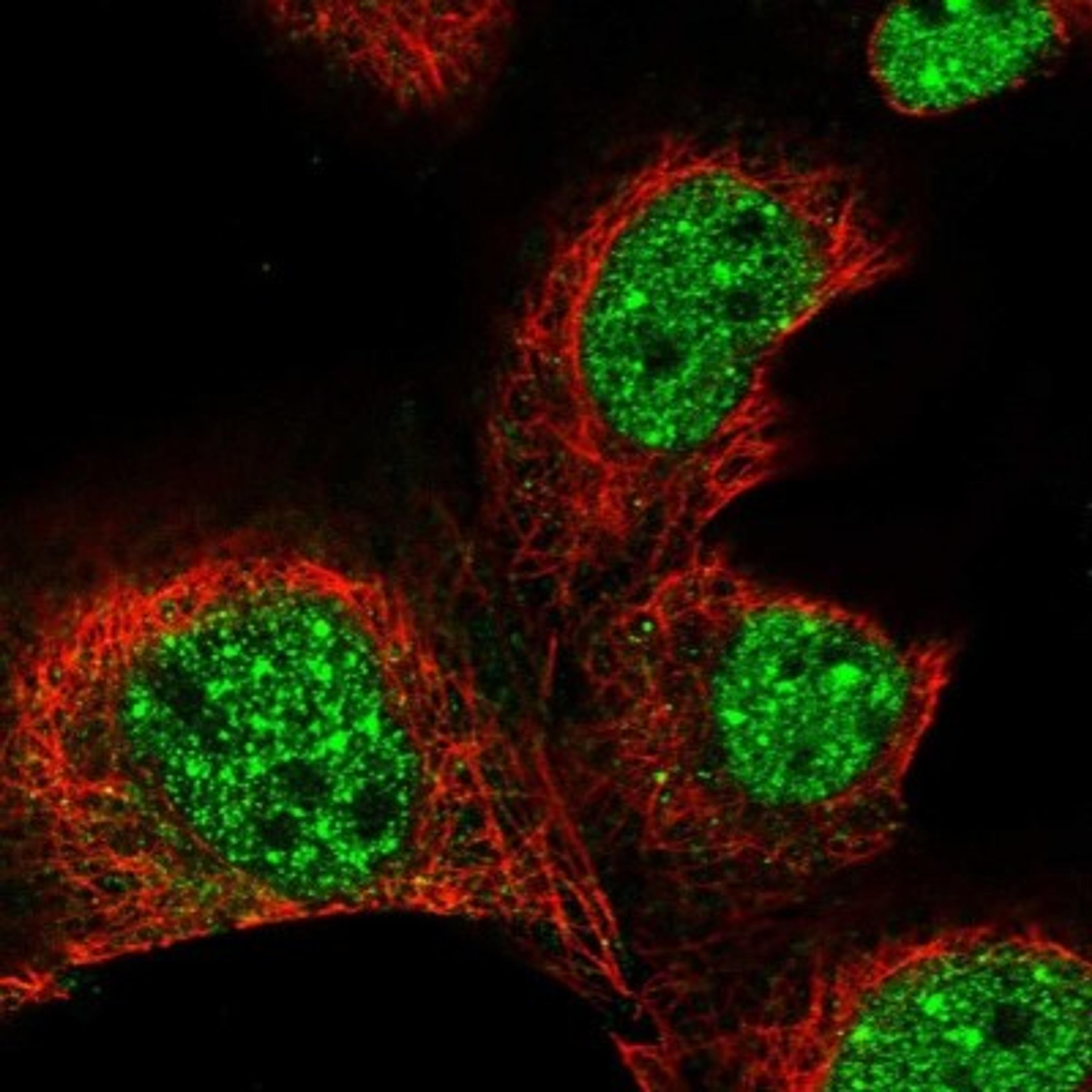 Immunocytochemistry/Immunofluorescence: KLHL17 Antibody [NBP1-85926] - Immunofluorescent staining of human cell line A-431 shows positivity in nucleus but not nucleoli.