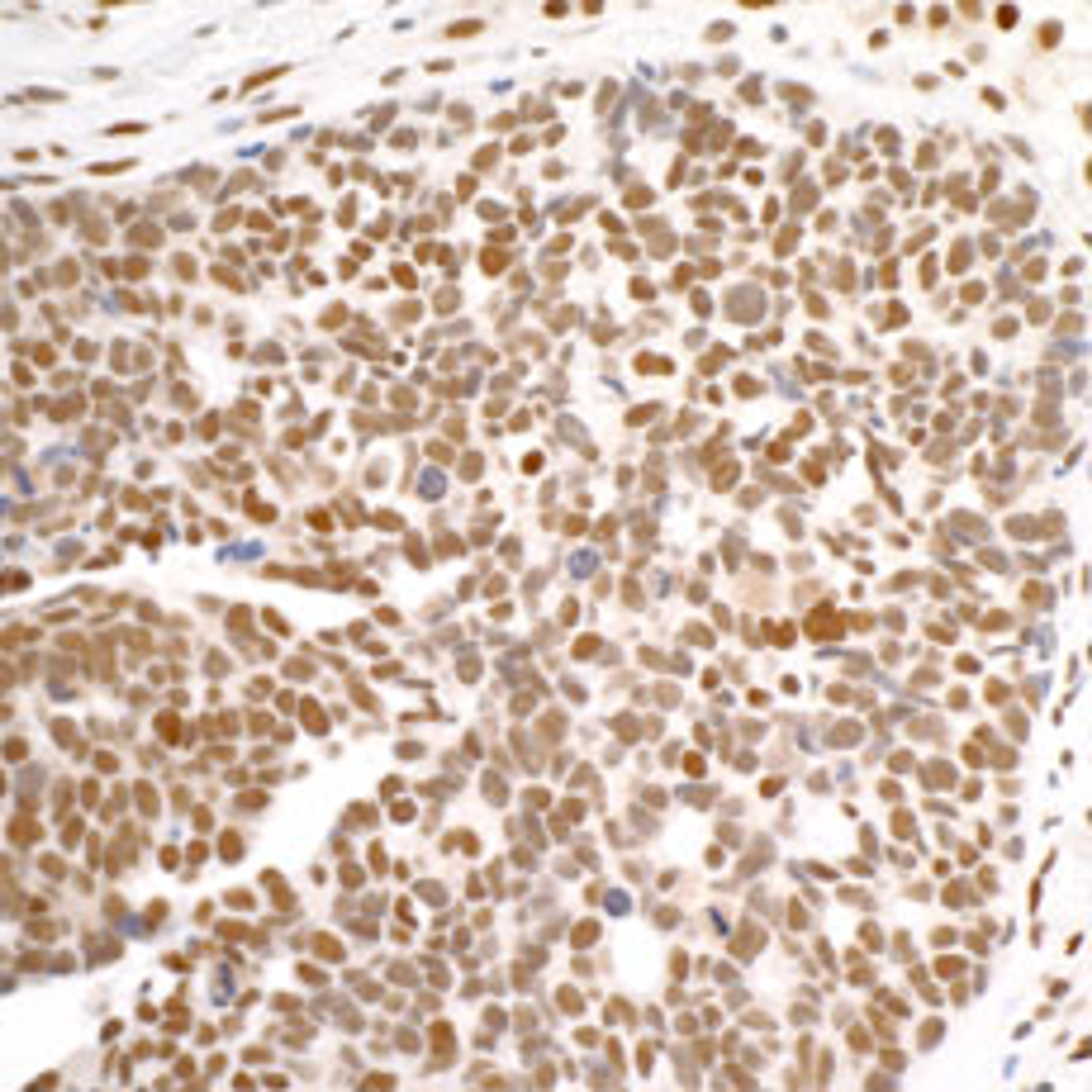 Detection of human DDX1 by immunohistochemistry.