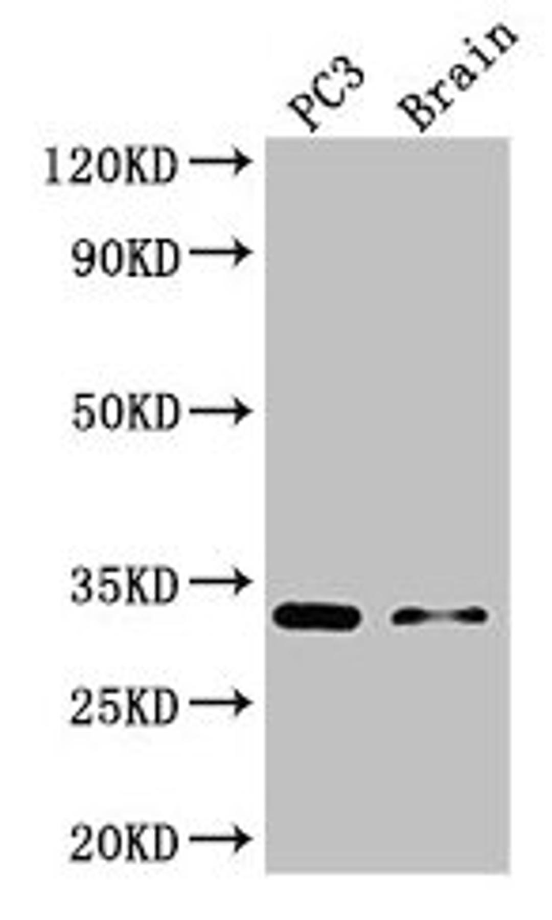 Western Blot. Positive WB detected in: PC-3 whole cell lysate, Mouse brain tissue. All lanes: HOXB13 antibody at 3µg/ml. Secondary. Goat polyclonal to rabbit IgG at 1/50000 dilution. Predicted band size: 31 kDa. Observed band size: 31 kDa