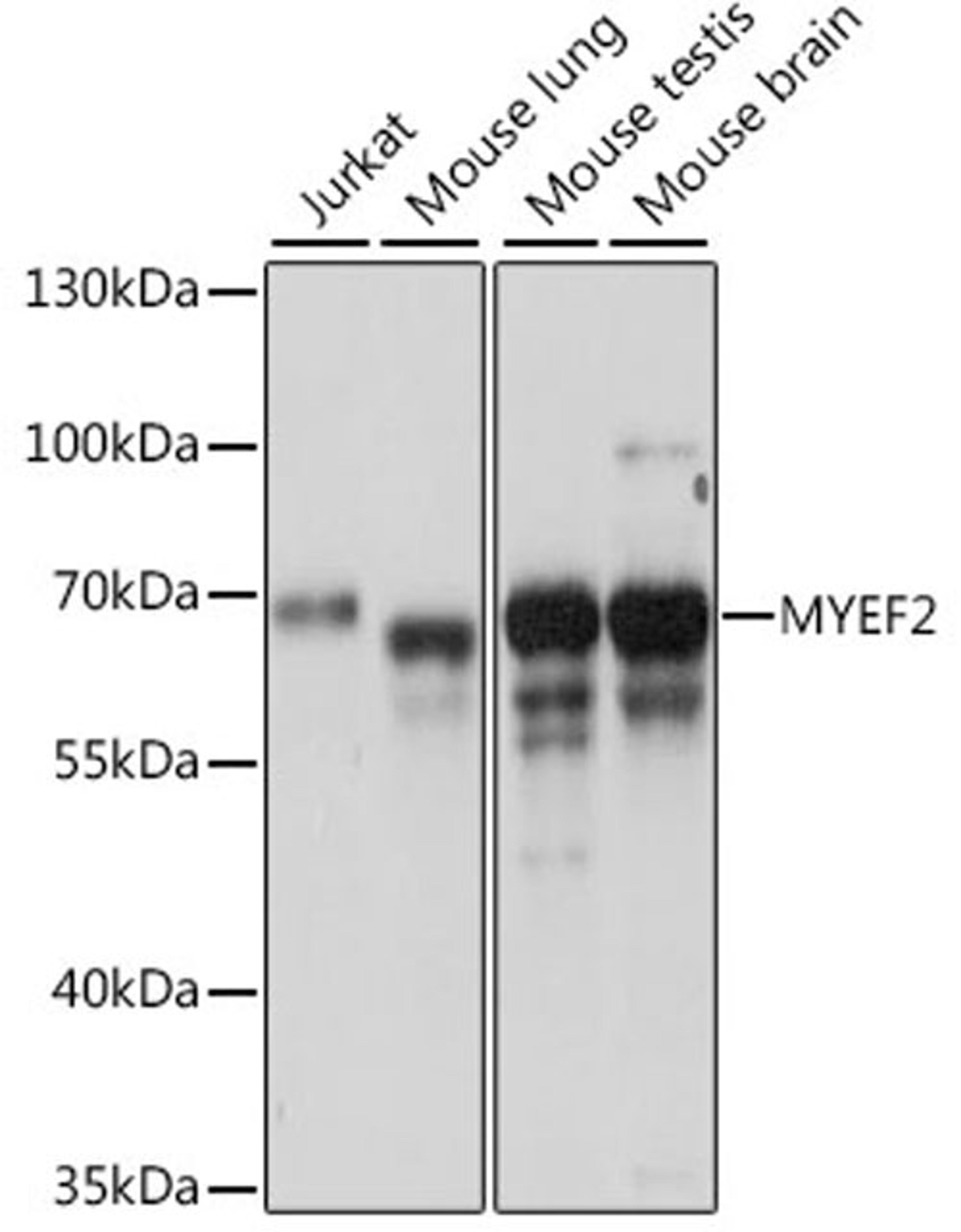 Western blot - MYEF2 antibody (A15829)