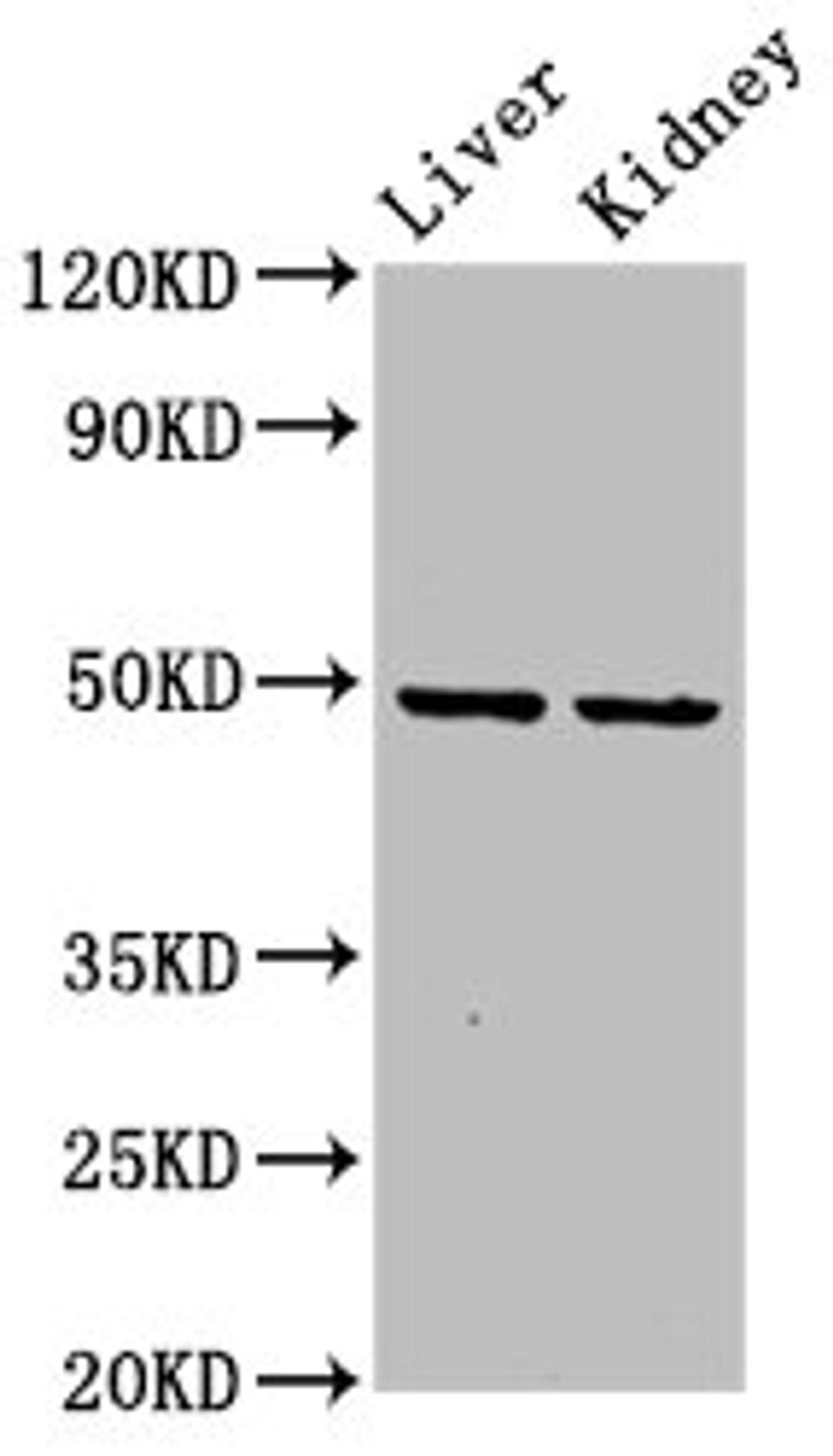 Western Blot. Positive WB detected in: Rat liver tissue, Rat kidney tissue. All lanes: DLST antibody at 5.9ug/ml. Secondary. Goat polyclonal to rabbit IgG at 1/50000 dilution. Predicted band size: 49, 40 kDa. Observed band size: 49 kDa. 