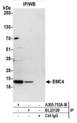 Detection of human EMC4 by WB of IP.