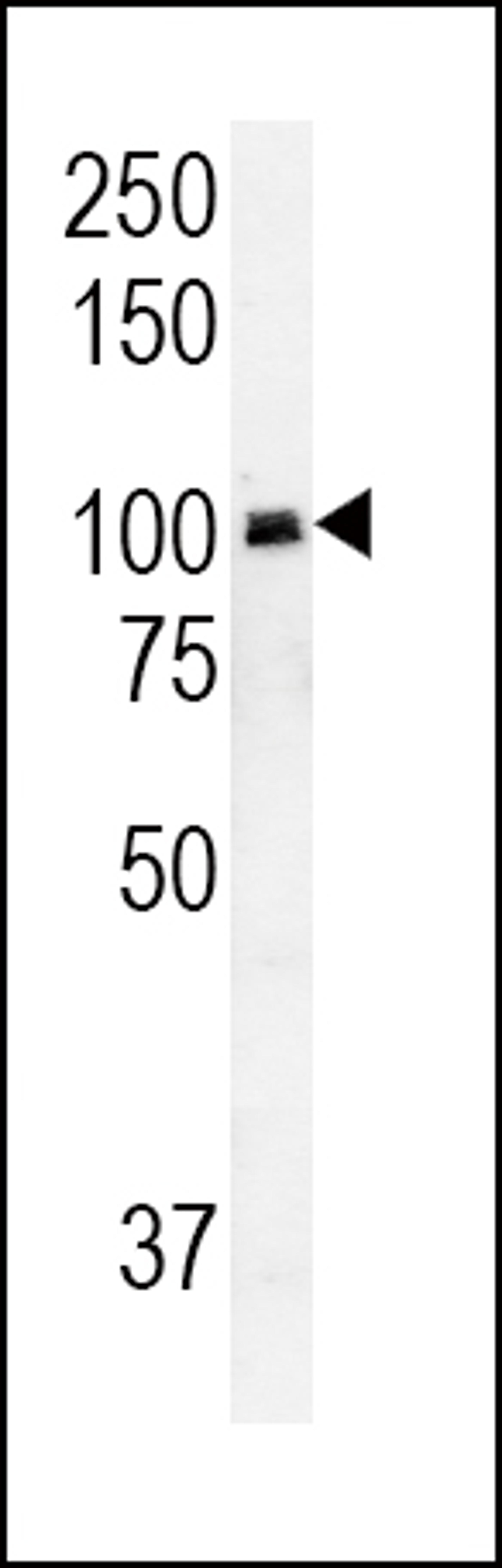 Western blot analysis in HepG2 cell line lysates (35ug/lane).