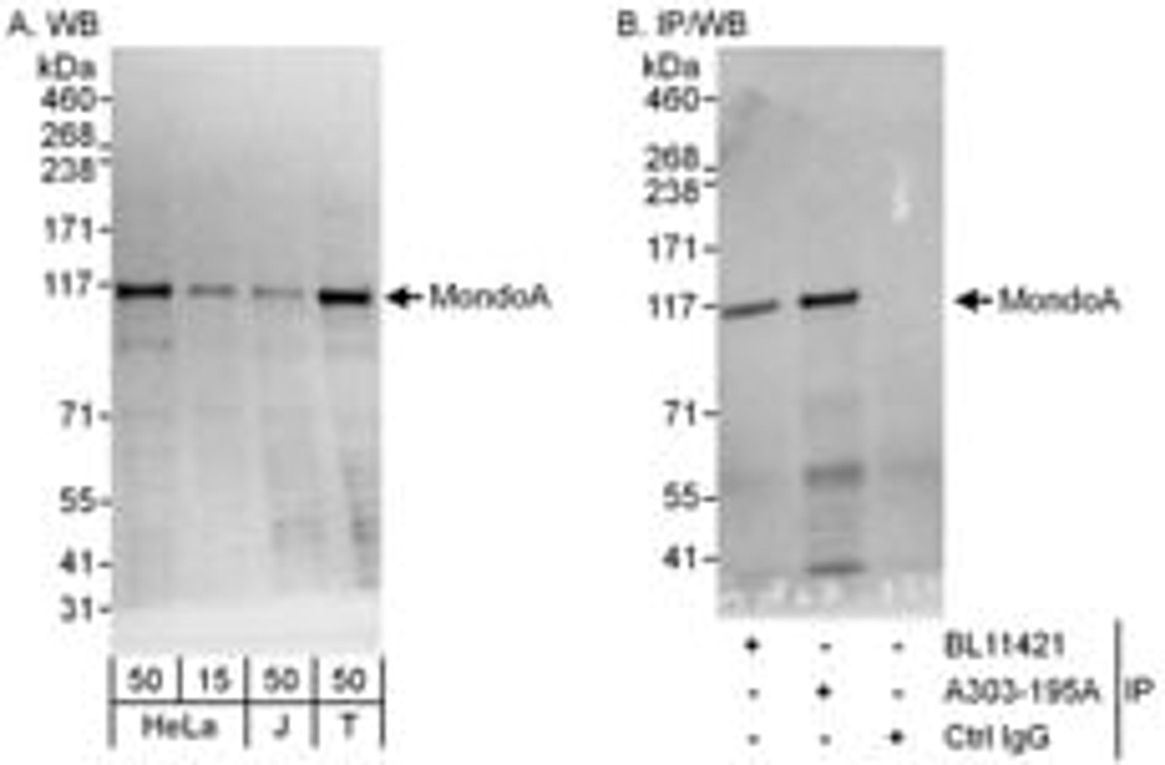 Detection of human MondoA by western blot and immunoprecipitation.