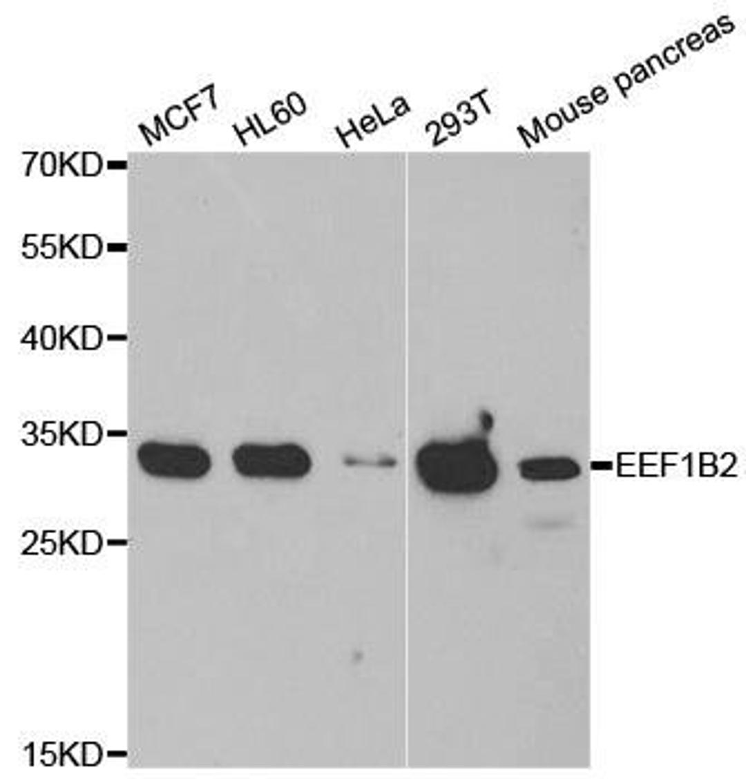 Western blot analysis of extracts of various cell lines using EEF1B2 antibody