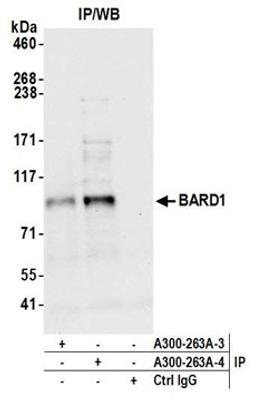 Detection of human BARD1 by western blot of immunoprecipitates.