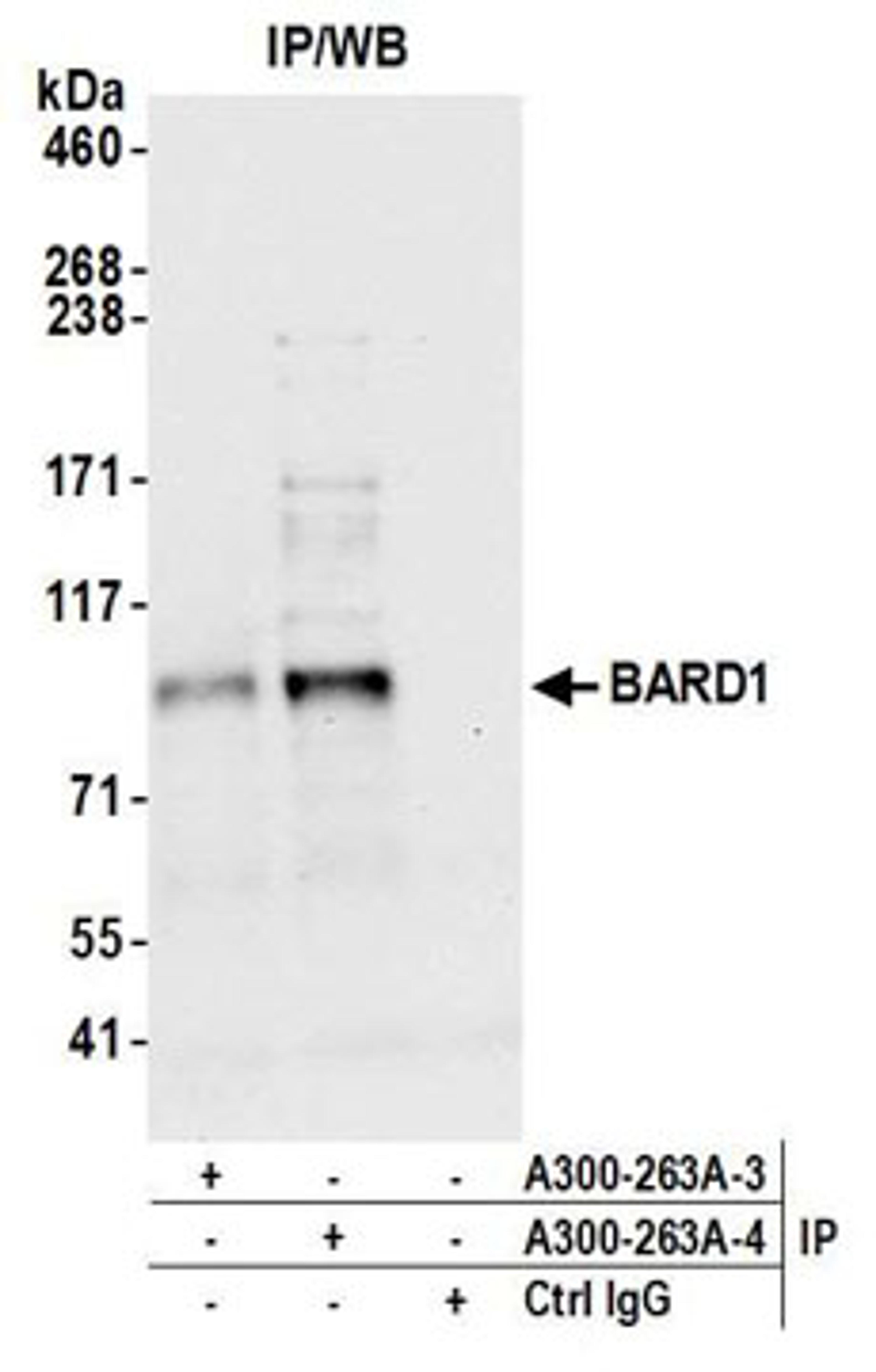 Detection of human BARD1 by western blot of immunoprecipitates.