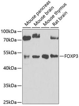 Western blot - FOXP3 antibody (A5706)