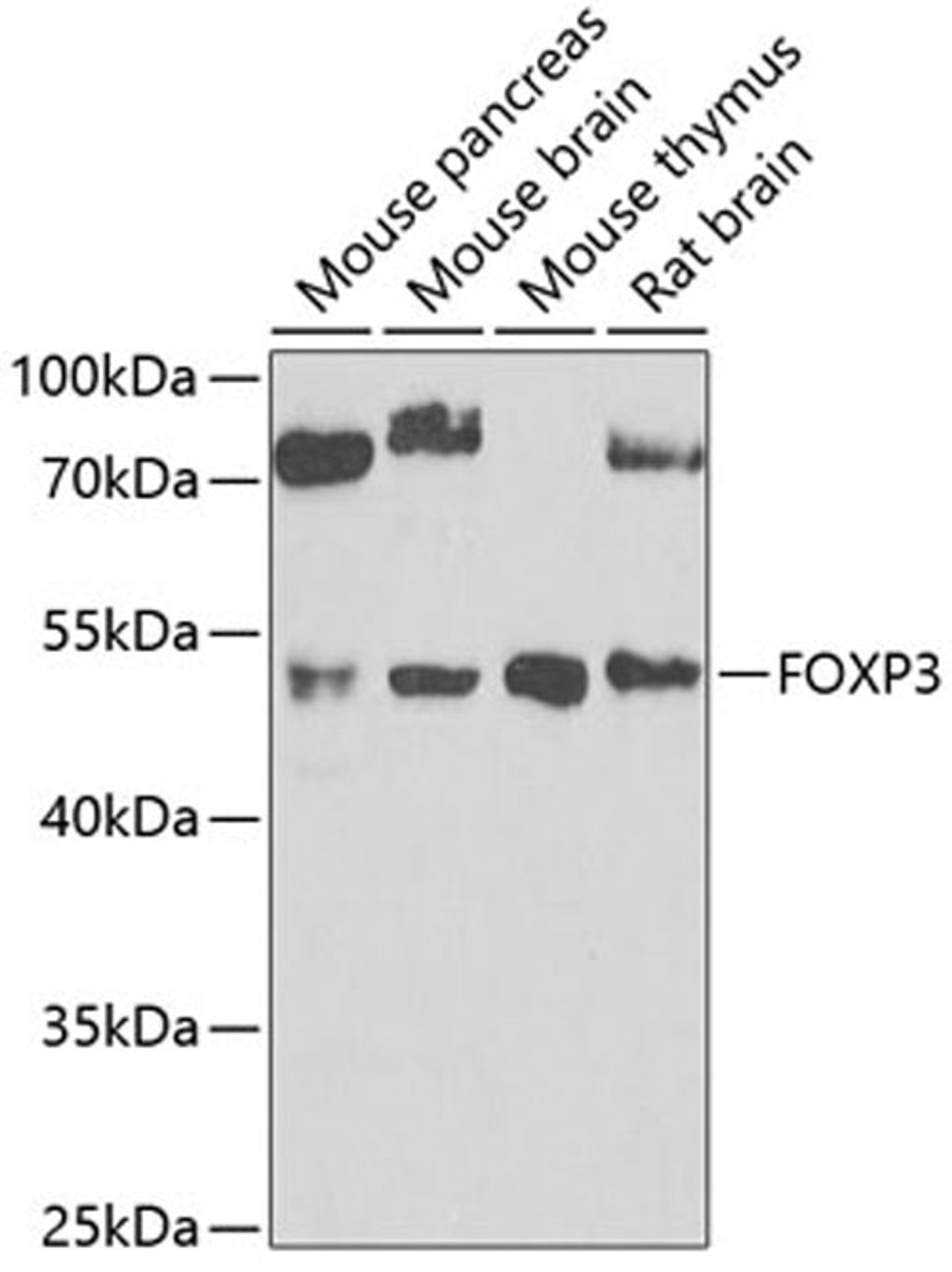 Western blot - FOXP3 antibody (A5706)