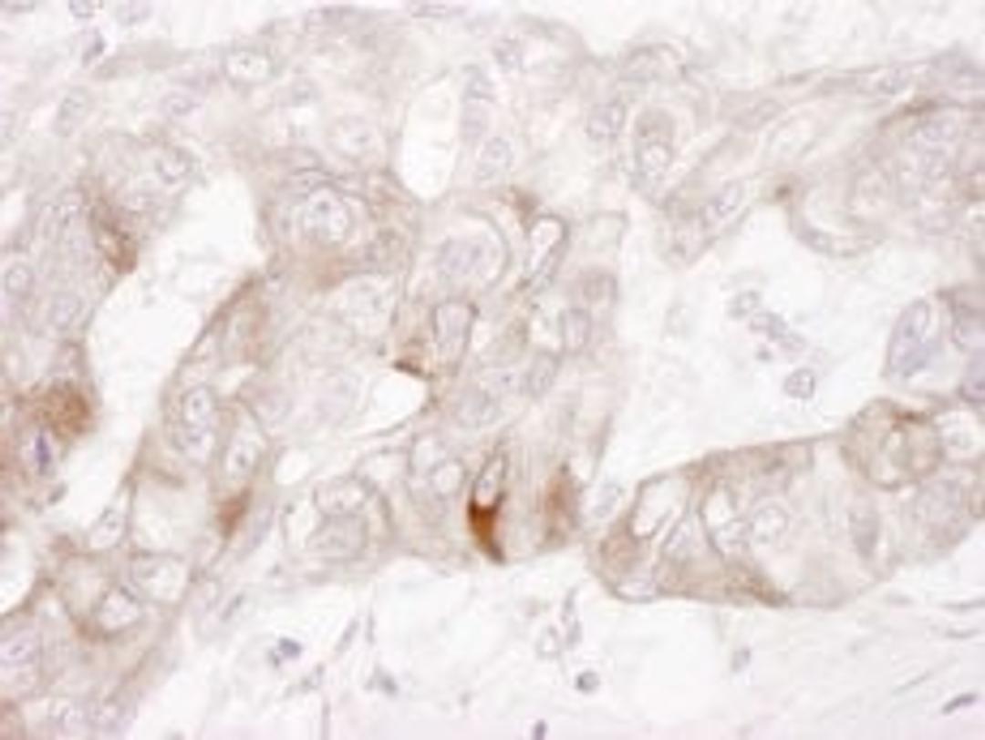 Detection of human c-Kit by immunohistochemistry.