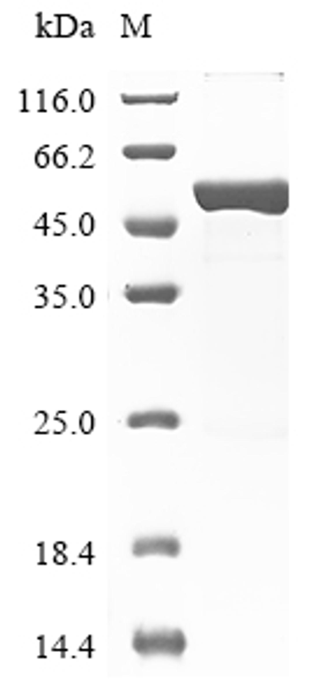 (Tris-Glycine gel) Discontinuous SDS-PAGE (reduced) with 5% enrichment gel and 15% separation gel.