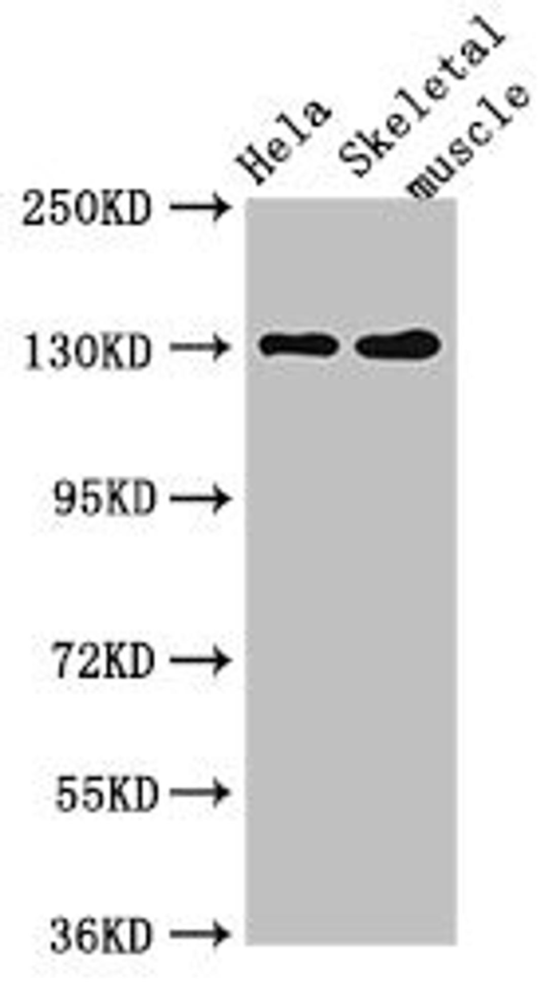 Western Blot. Positive WB detected in: Hela whole cell lysate, Mouse skeletal muscle tissue. All lanes: PER3 antibody at 4µg/ml. Secondary. Goat polyclonal to rabbit IgG at 1/50000 dilution. Predicted band size: 132, 133 kDa. Observed band size: 132 kDa