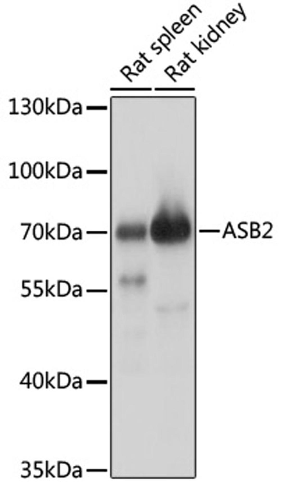 Western blot - ASB2 antibody (A17923)