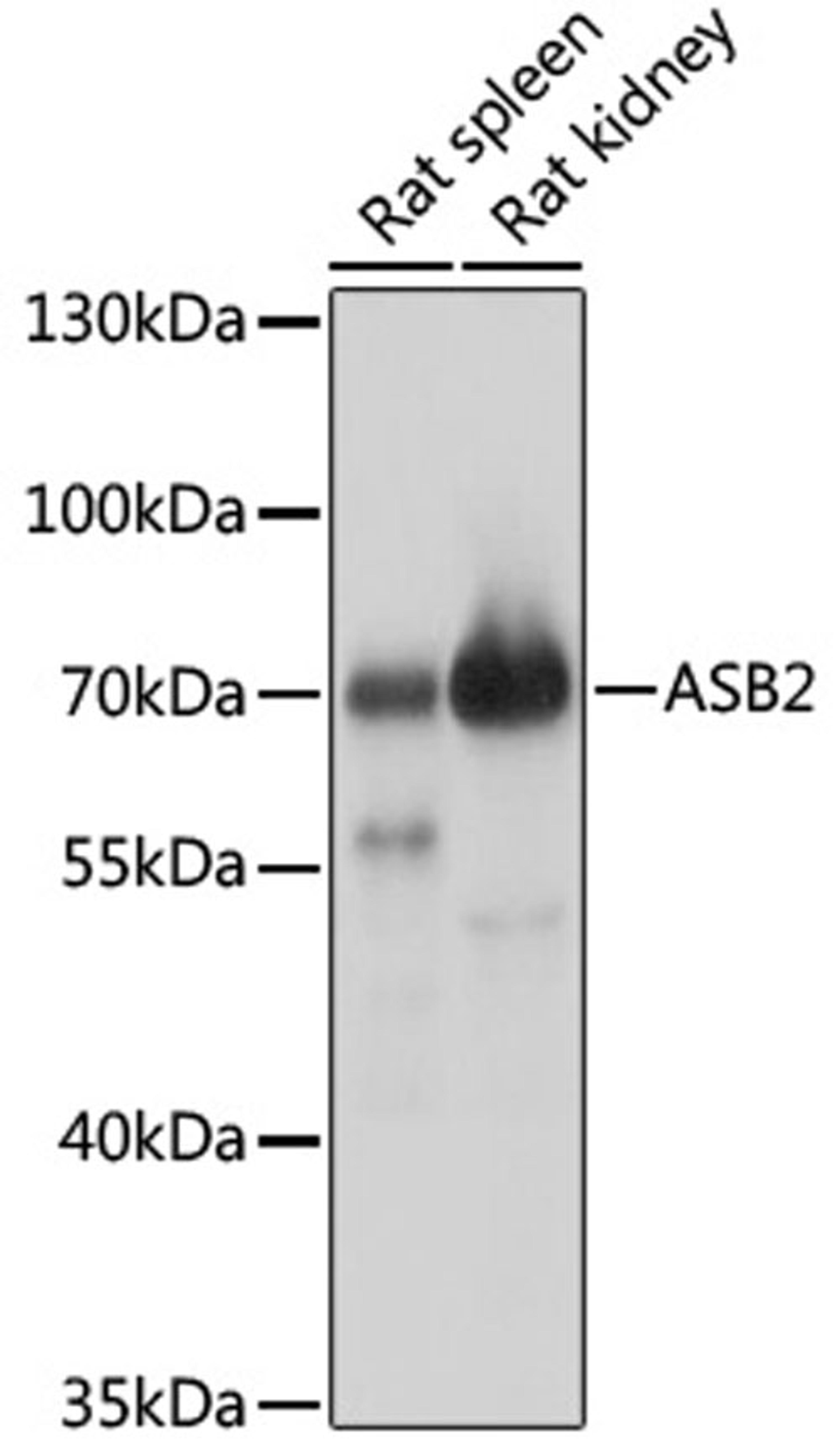 Western blot - ASB2 antibody (A17923)