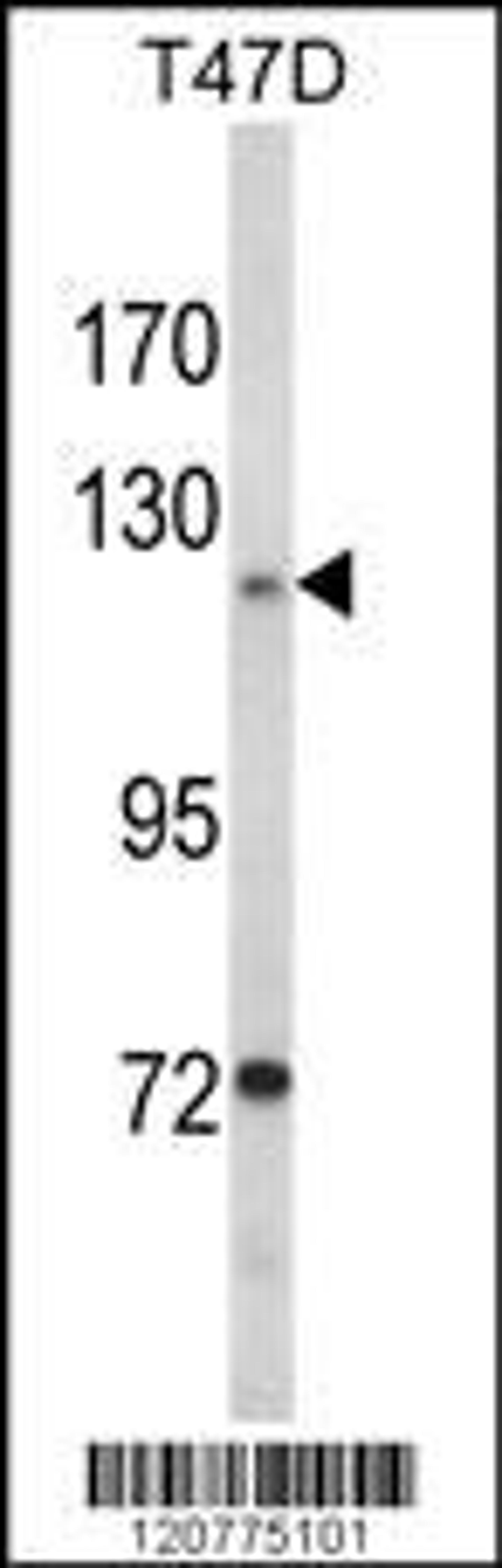 Western blot analysis of PTK2 Antibody in T47D cell line lysates (35ug/lane)