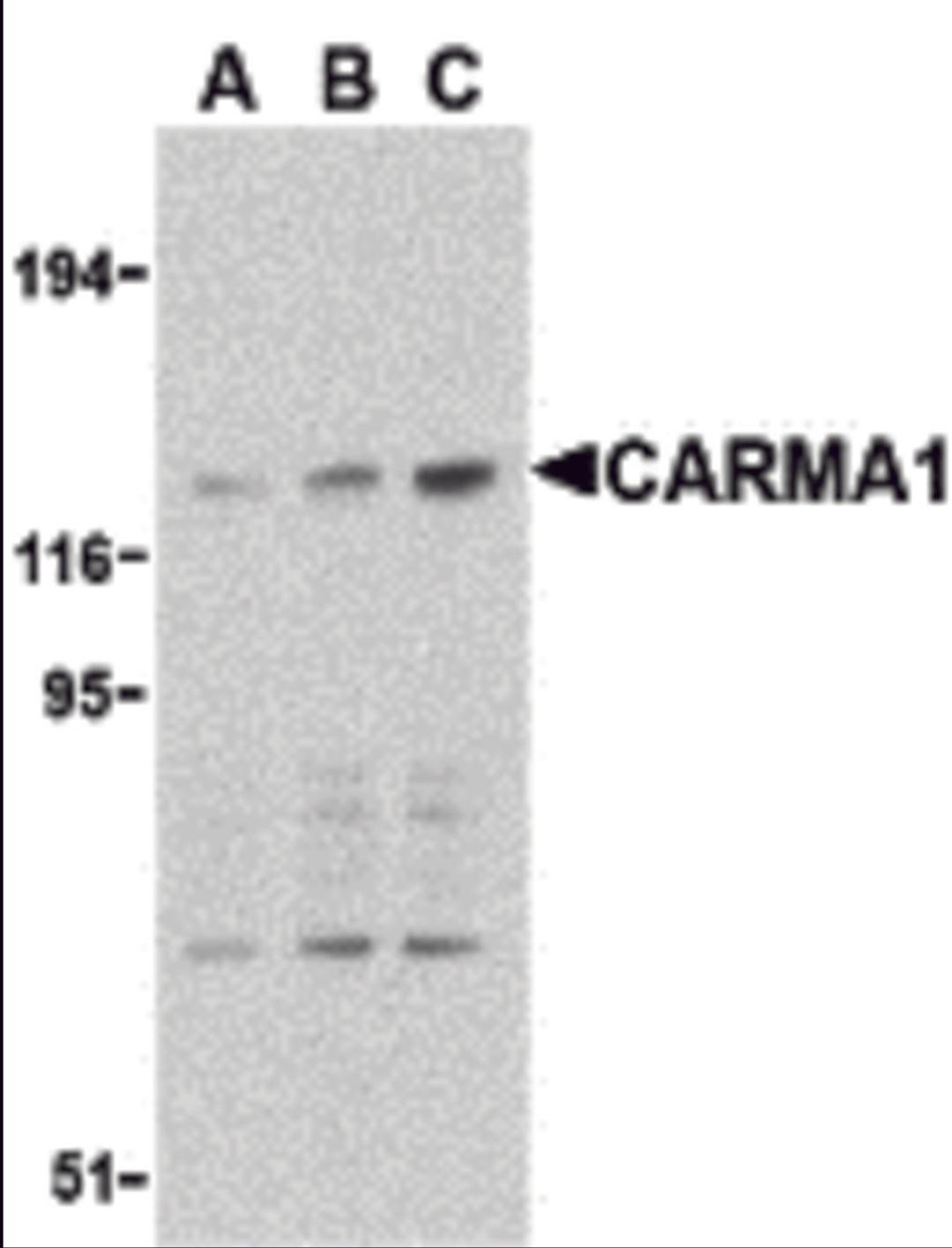 Western blot analysis of CARMA1 expression in mouse thymus cell lysate with CARMA1 antibody at 0.5 (lane A), 1 (lane B), and 2 &#956;g /ml (lane C), respectively. 