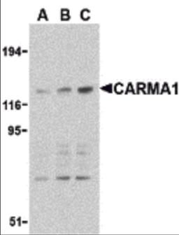 Western blot analysis of CARMA1 expression in mouse thymus cell lysate with CARMA1 antibody at 0.5 (lane A), 1 (lane B), and 2 μg /ml (lane C), respectively.