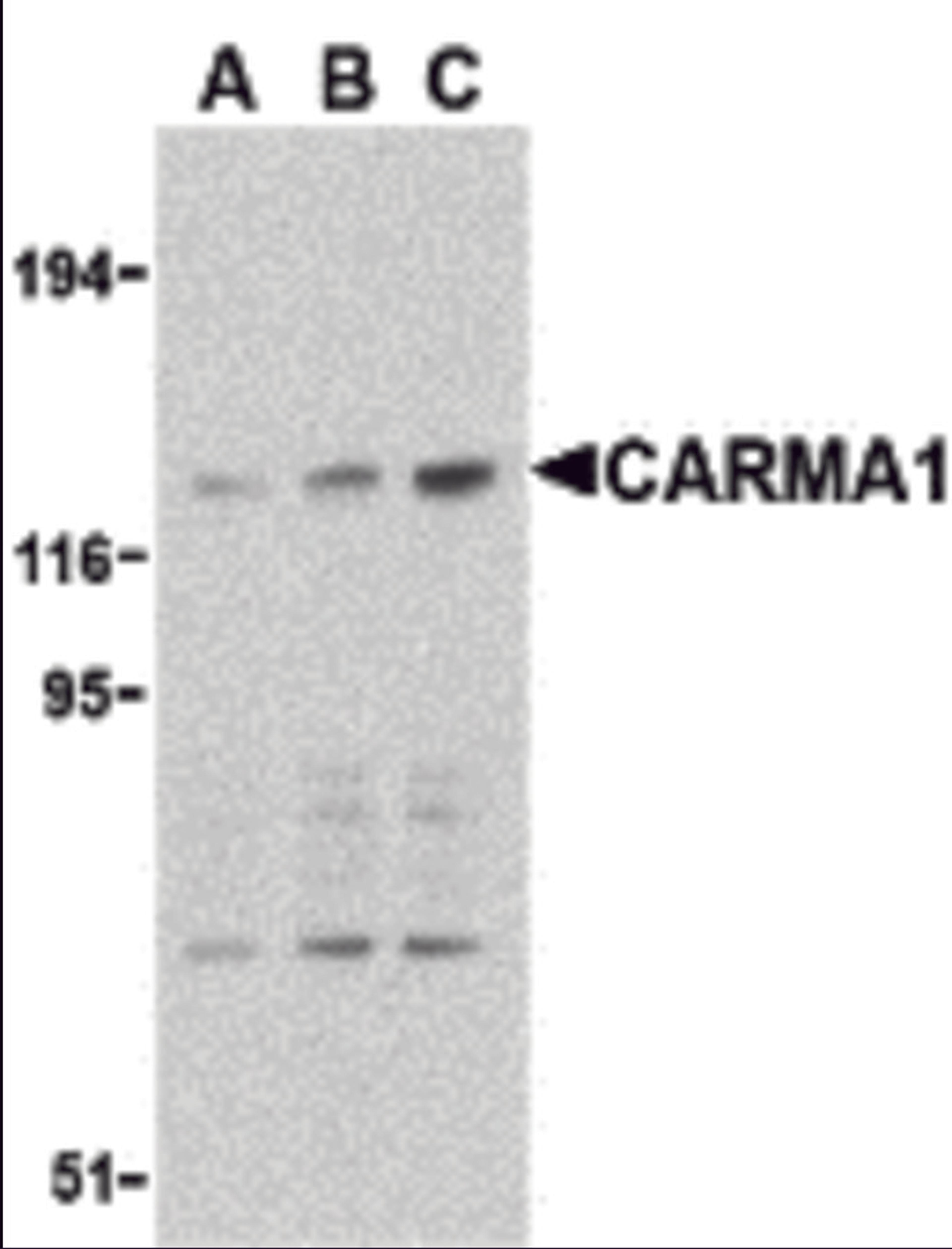 Western blot analysis of CARMA1 expression in mouse thymus cell lysate with CARMA1 antibody at 0.5 (lane A), 1 (lane B), and 2 μg /ml (lane C), respectively.