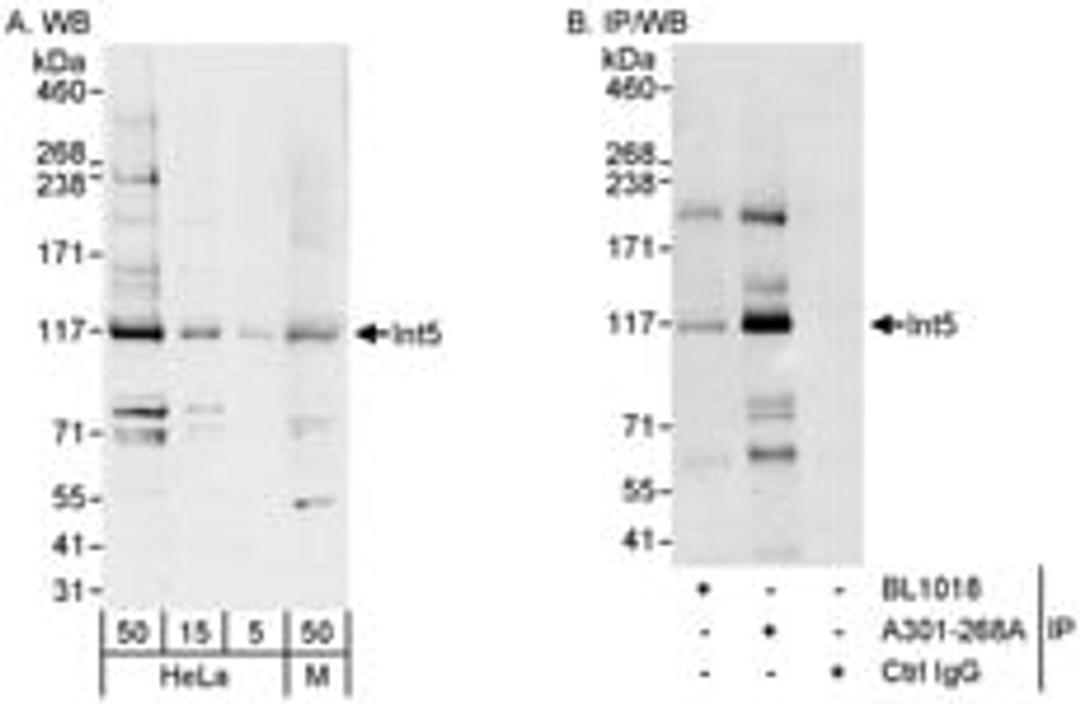 Detection of human and mouse Int5 by western blot (h&m) and immunoprecipitation (h).