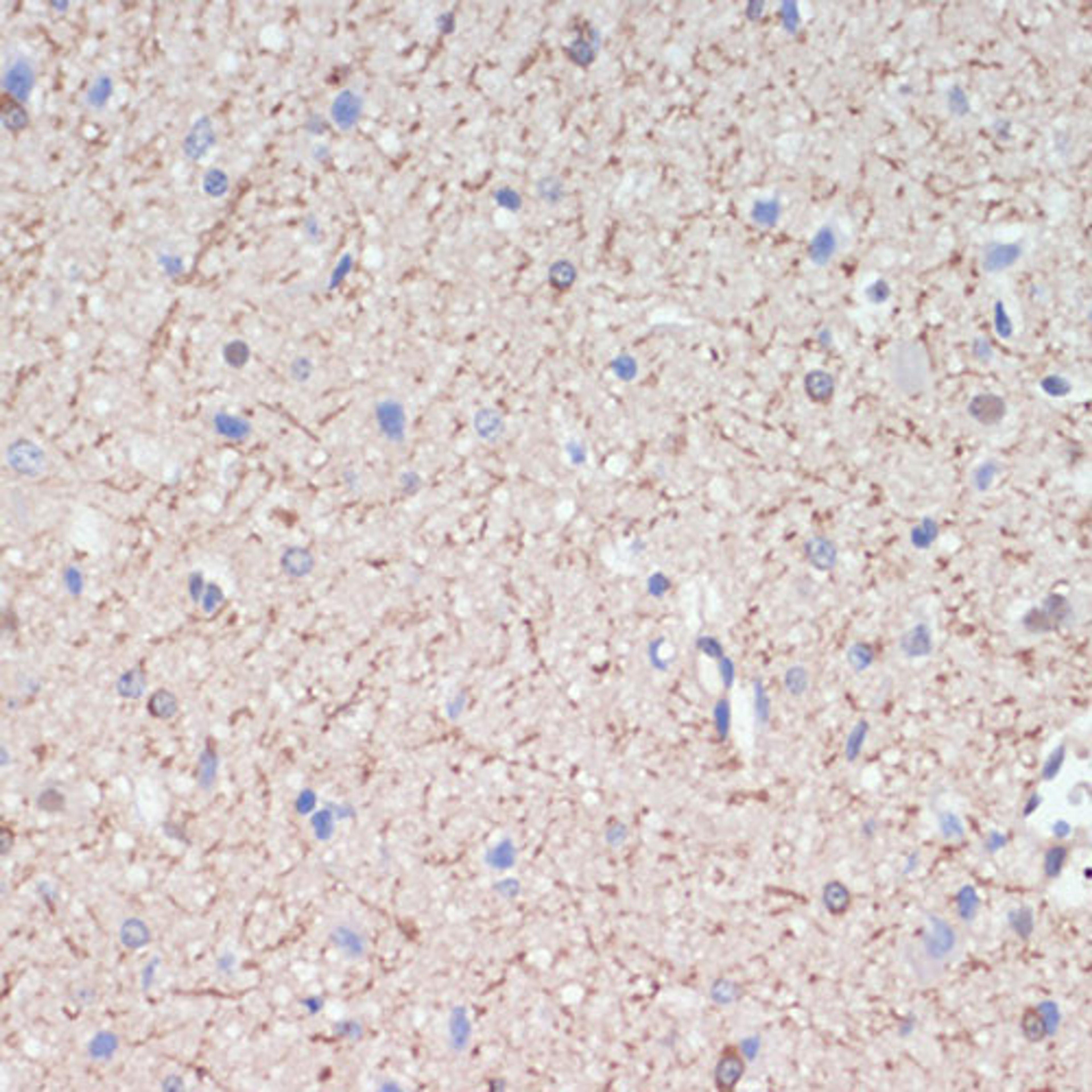 Immunohistochemistry - MAG antibody (A16914)