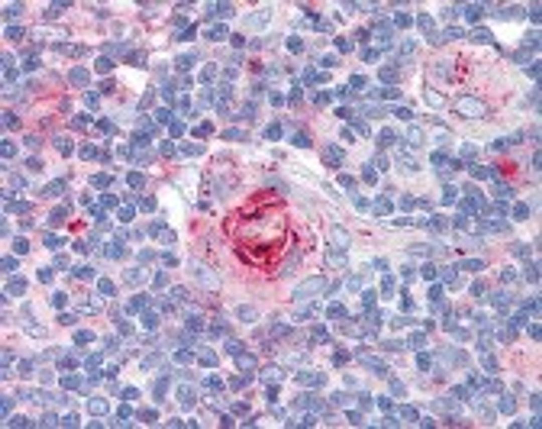 Immunohistochemistry staining of ICAM1 in thymus tissue using ICAM1 monoclonal Antibody.