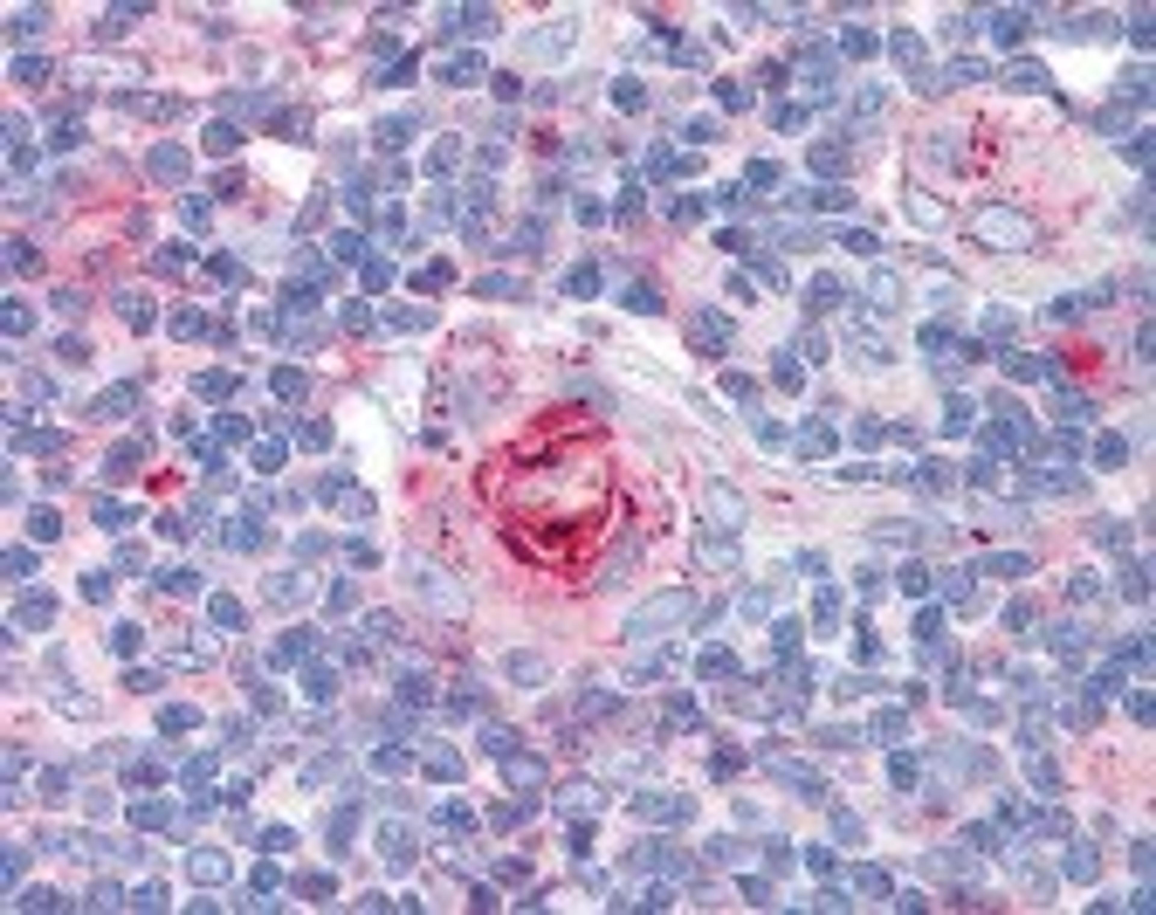 Immunohistochemistry staining of ICAM1 in thymus tissue using ICAM1 monoclonal Antibody.