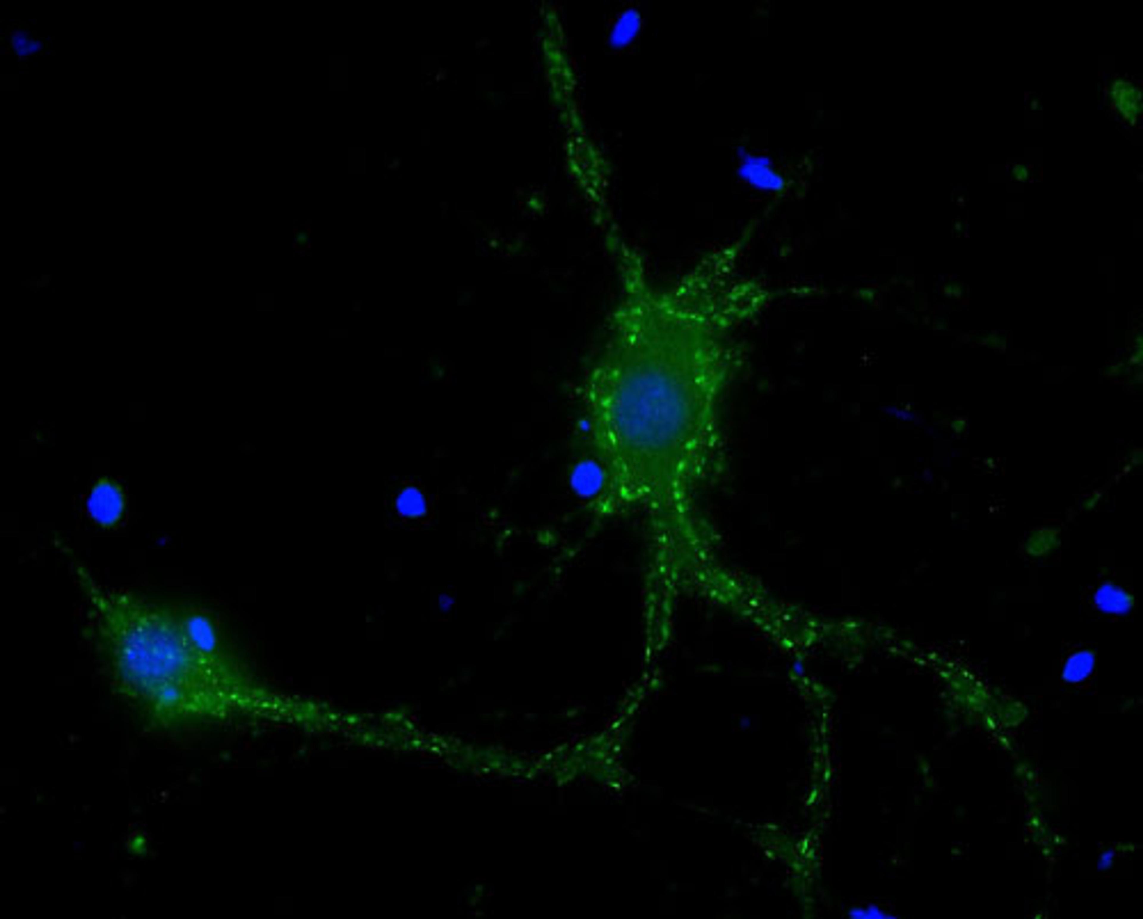 Rat hippocampus neurons stained with mouse anti-Synaptotagmin 1 and protag-HiSec anti-mouse IgG-X2 Atto 488 (Cat. No. 80205; green). Nuclei were stained using DAPI (blue)(courtesy of NanoTag Biotechnologies GmbH).
