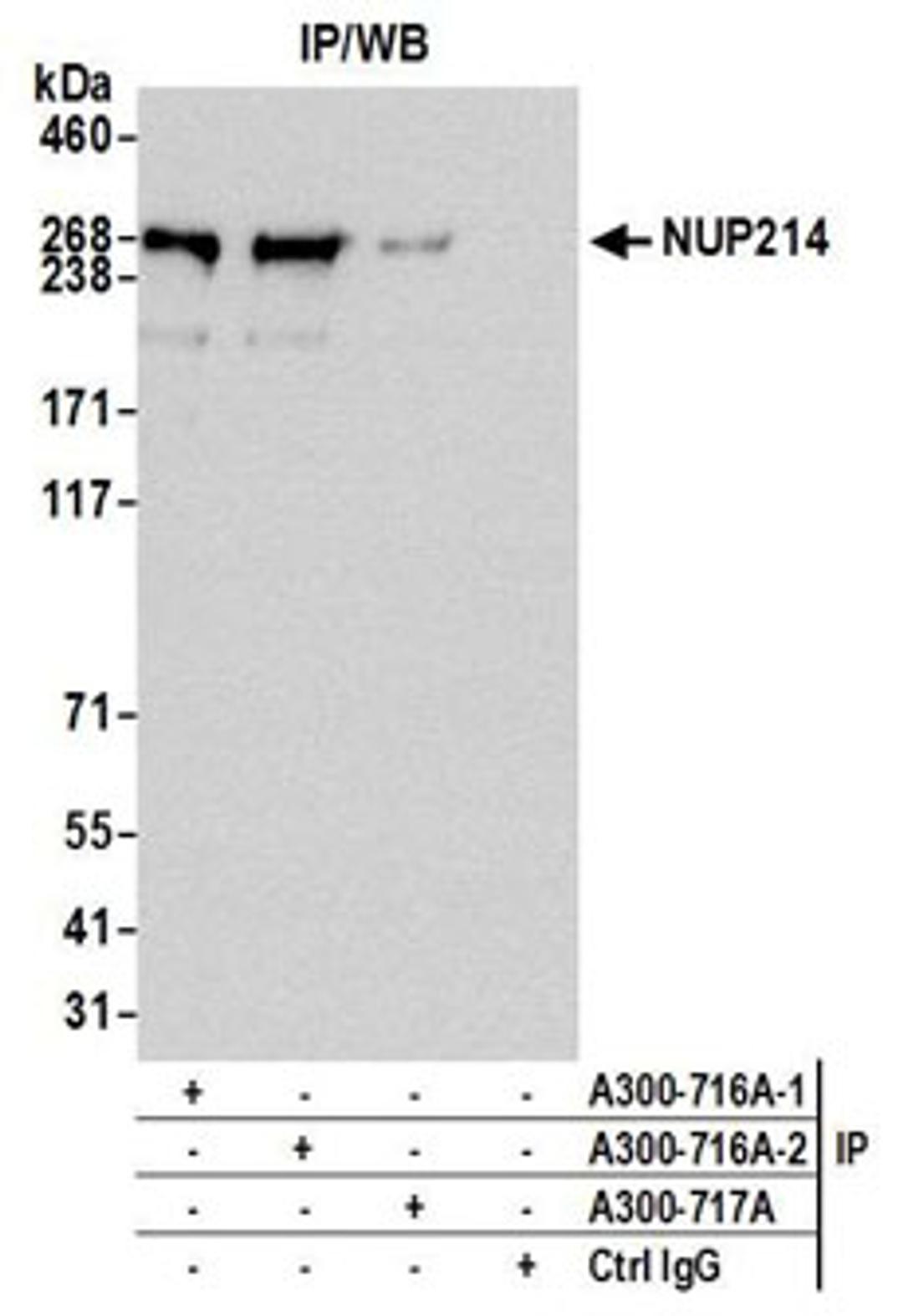 Detection of human NUP214 by western blot of immunoprecipitates.