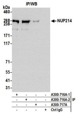 Detection of human NUP214 by western blot of immunoprecipitates.