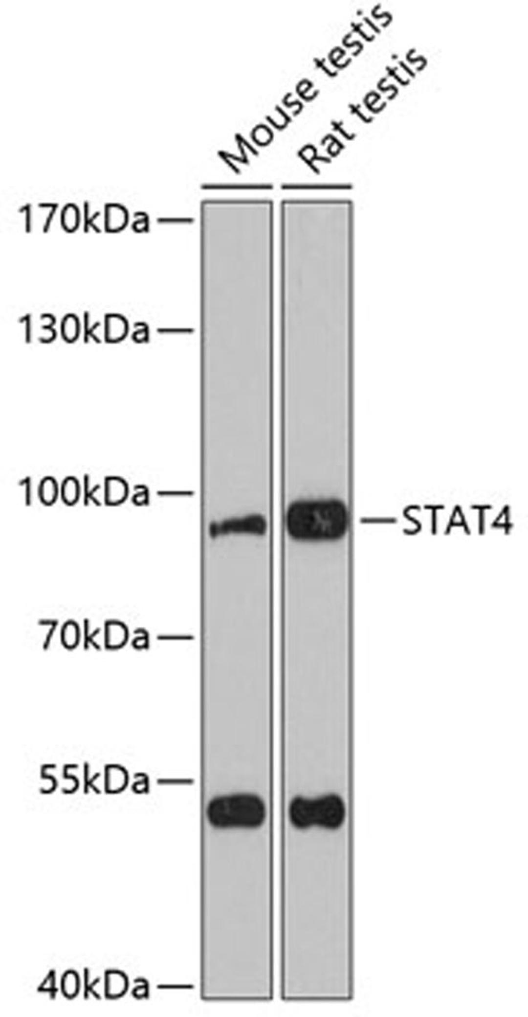 Western blot - STAT4 antibody (A2638)