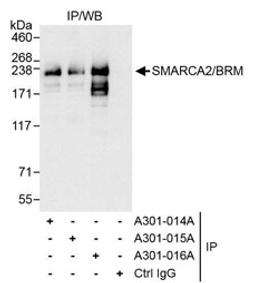 Detection of human SMARCA2/BRM by western blot of immunoprecipitates.